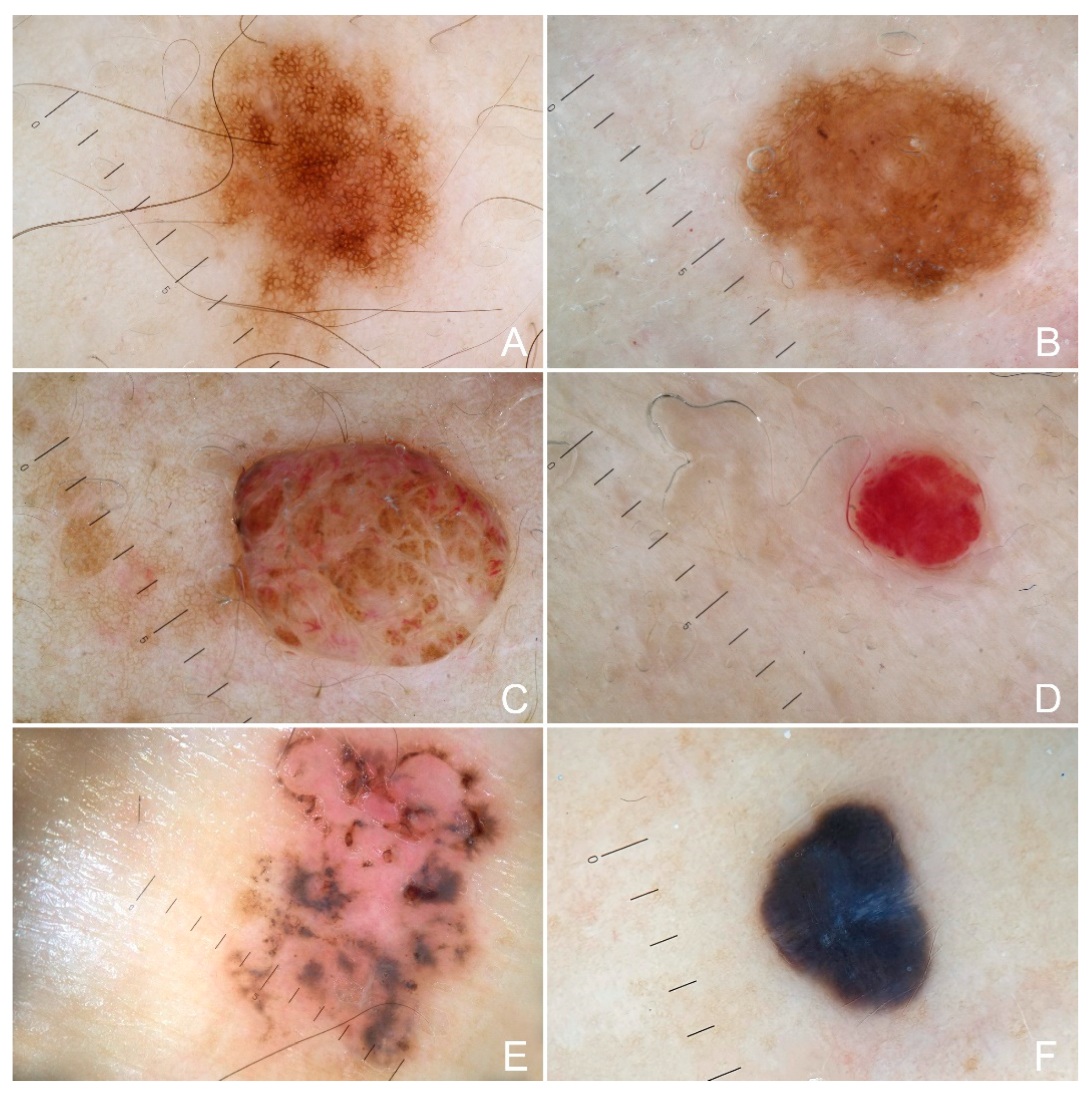 Cancers 15 00114 g001