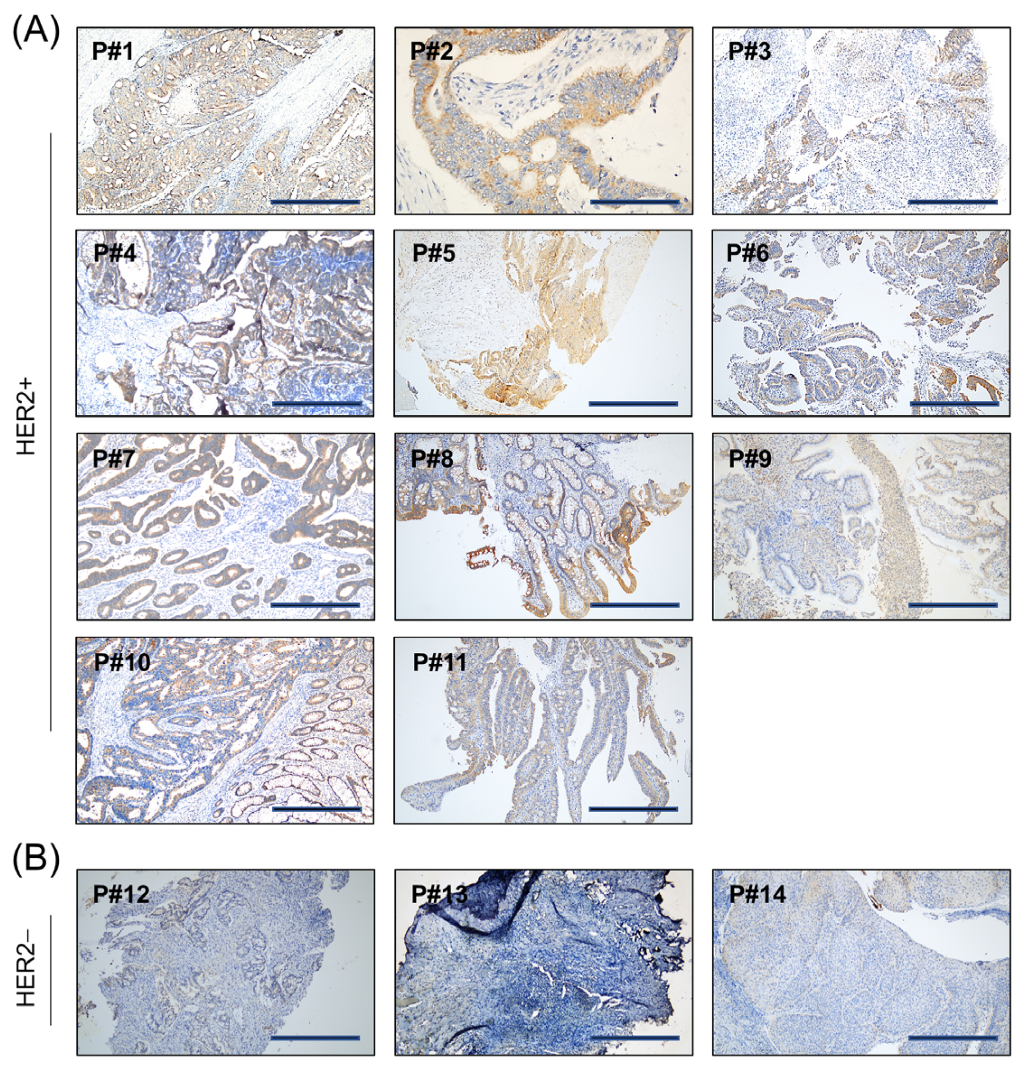 Cancers 15 00130 g003 Cancers 15 00130 g003