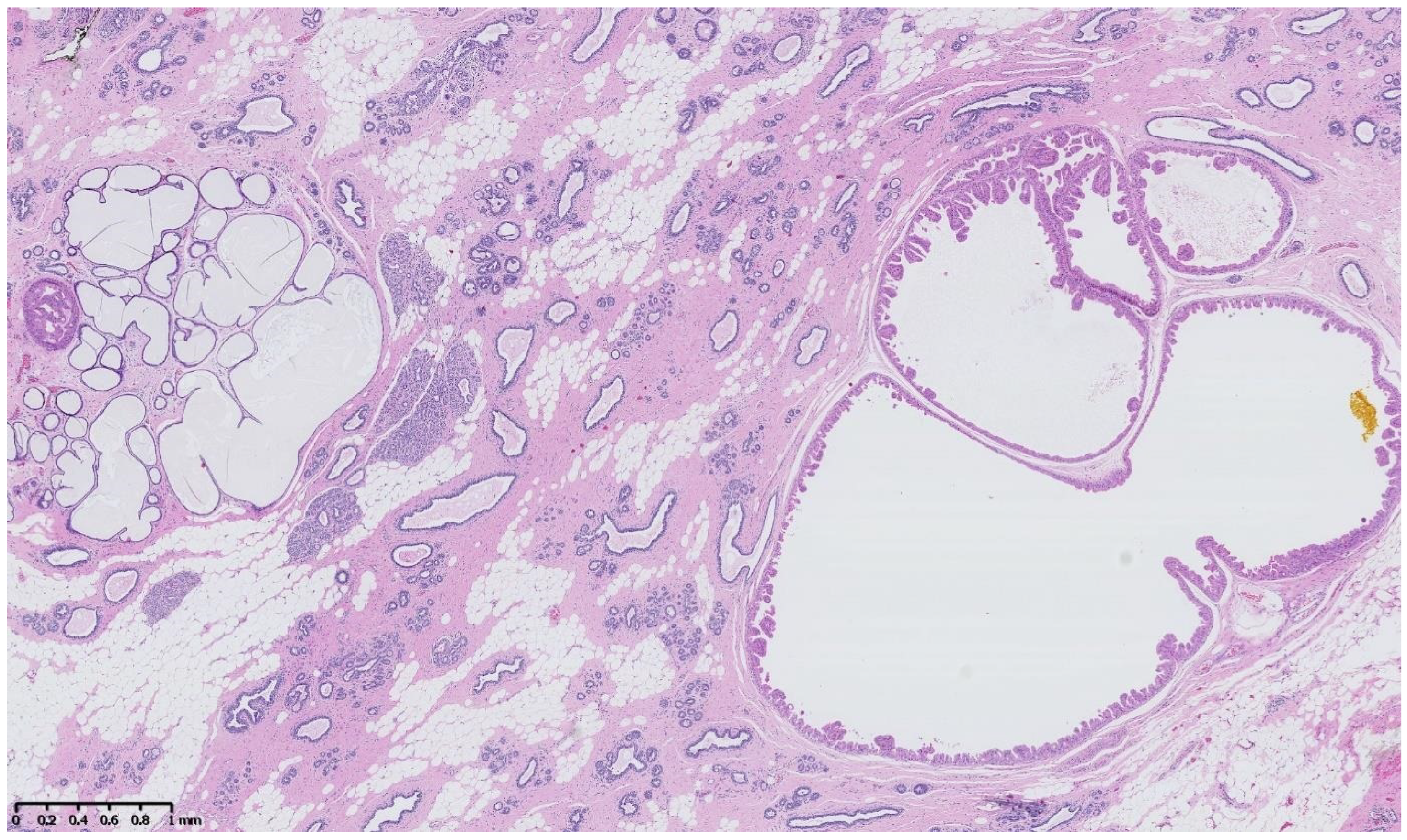 Cancers 15 00245 g002 Cancers 15 00245 g002