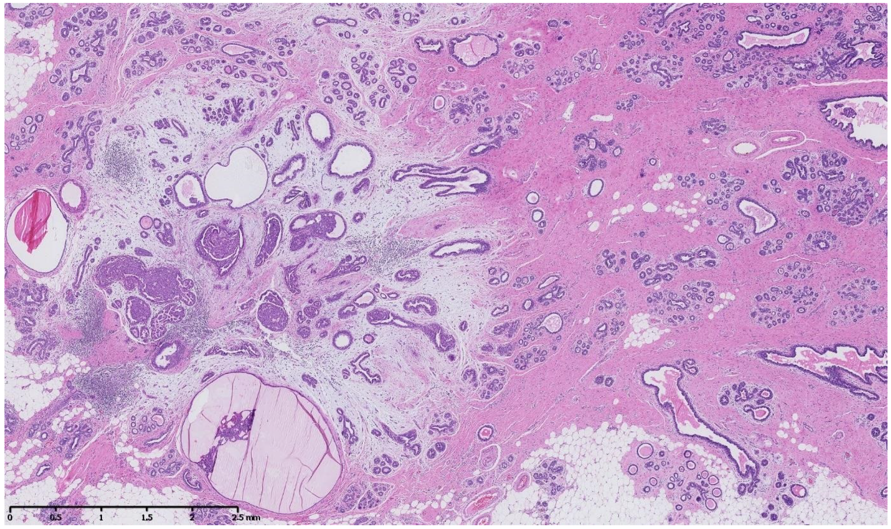 Cancers 15 00245 g003 Cancers 15 00245 g003