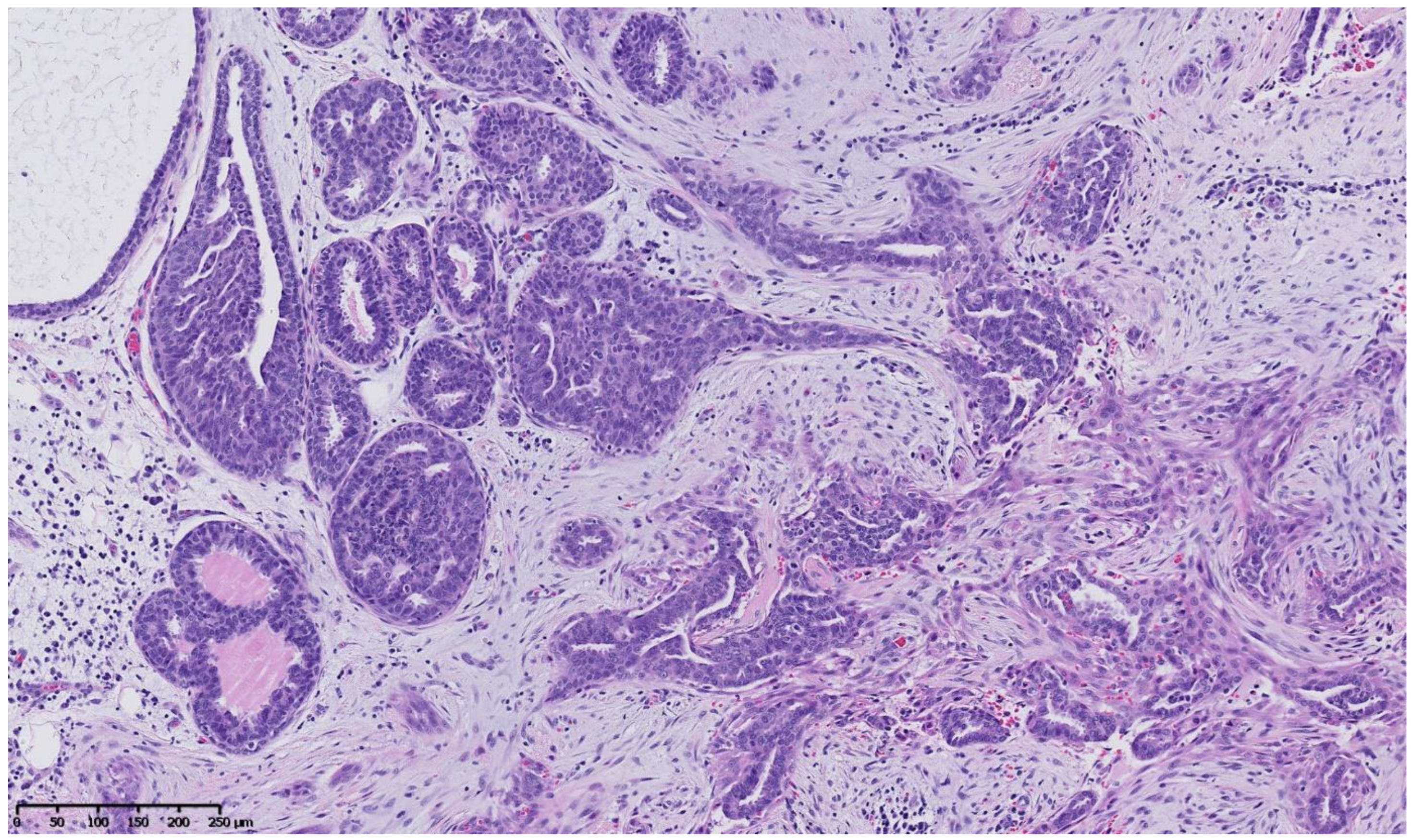 Cancers 15 00245 g004 Cancers 15 00245 g004