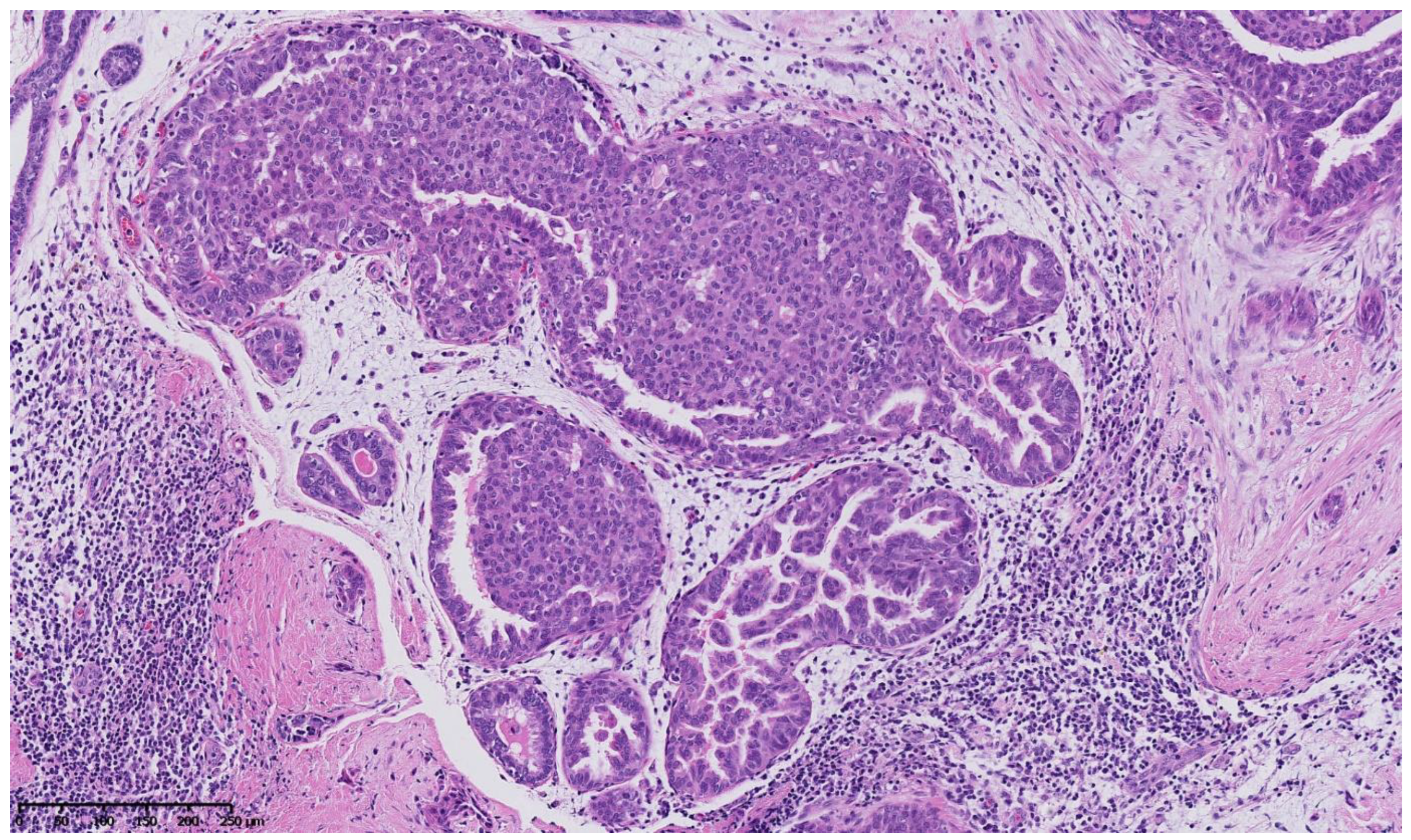 Cancers 15 00245 g005 Cancers 15 00245 g005