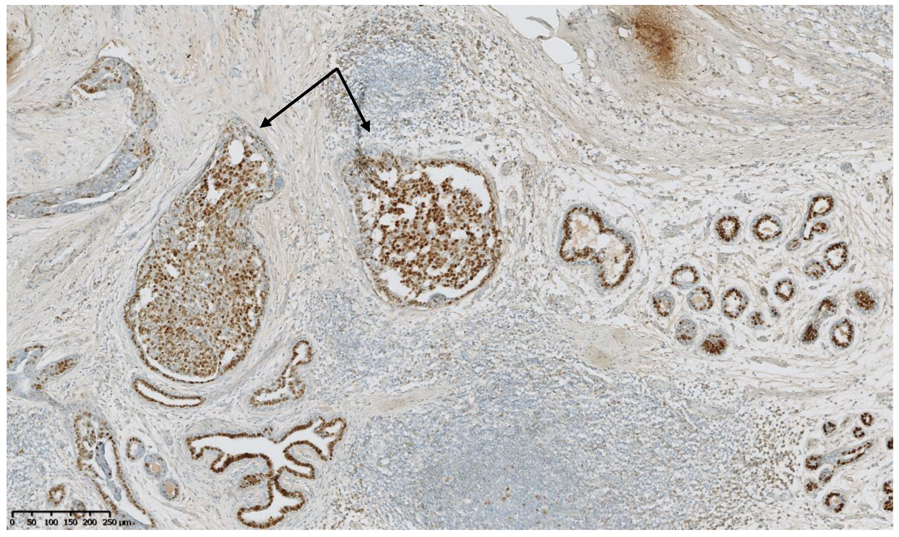 Cancers 15 00245 g006 Cancers 15 00245 g006