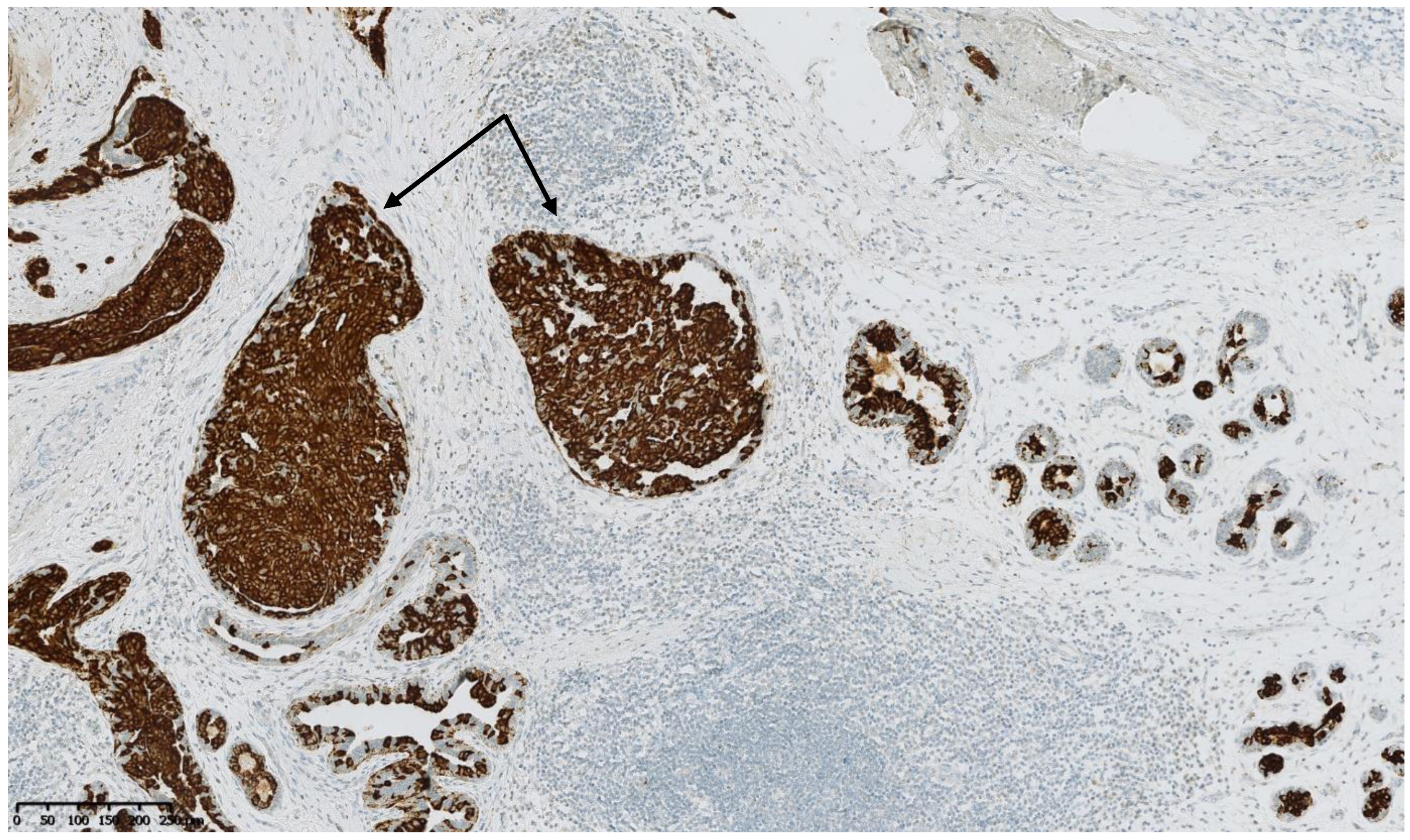 Cancers 15 00245 g007 Cancers 15 00245 g007