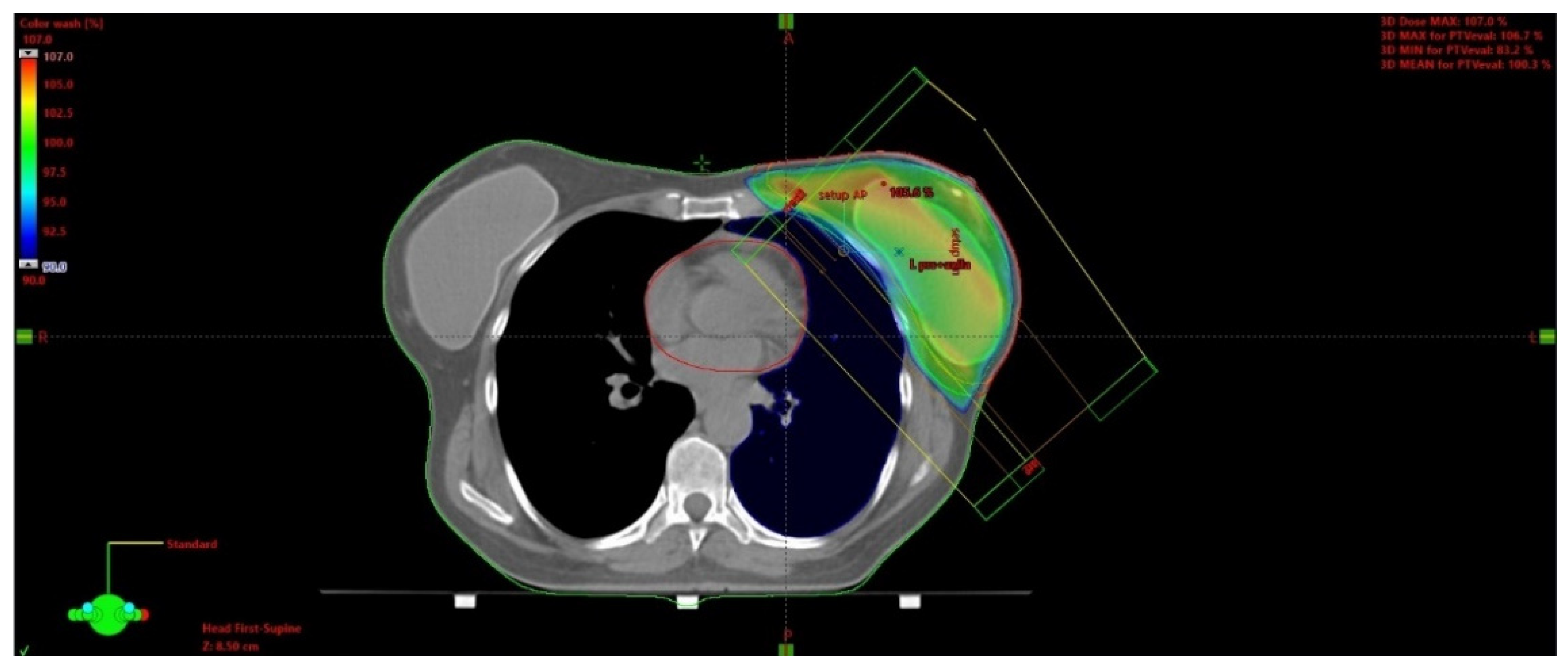 Cancers 15 00298 g003