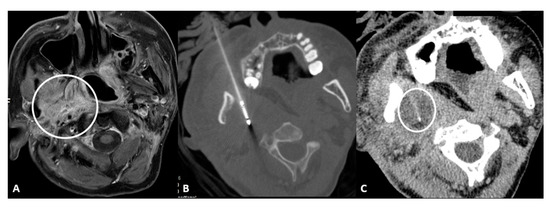 Cancers 15 00308 g001