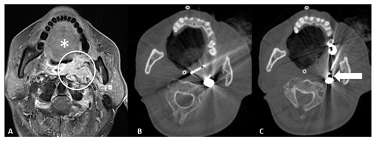 Cancers 15 00308 g002