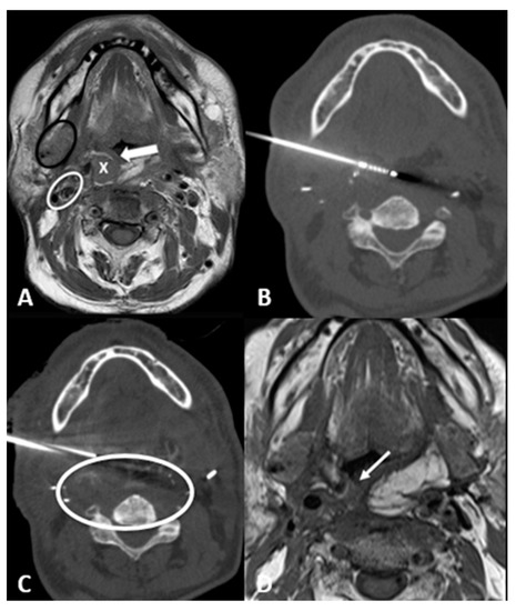Cancers 15 00308 g003