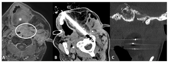 Cancers 15 00308 g004
