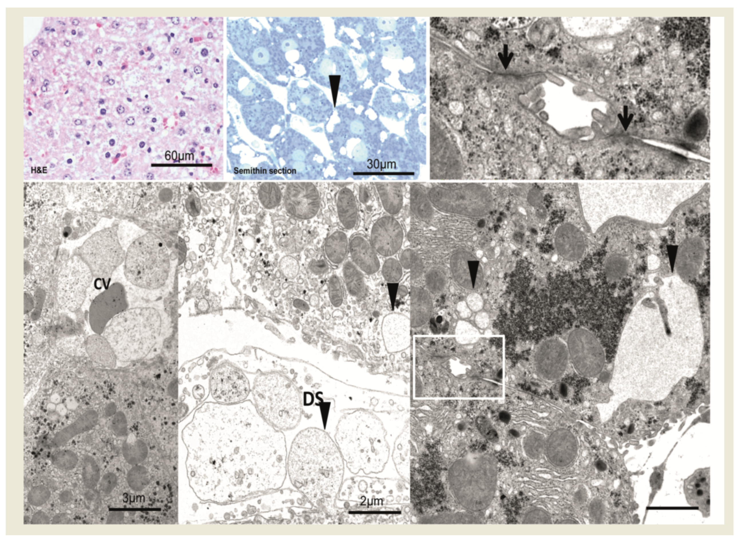 Cancers 15 00328 g003