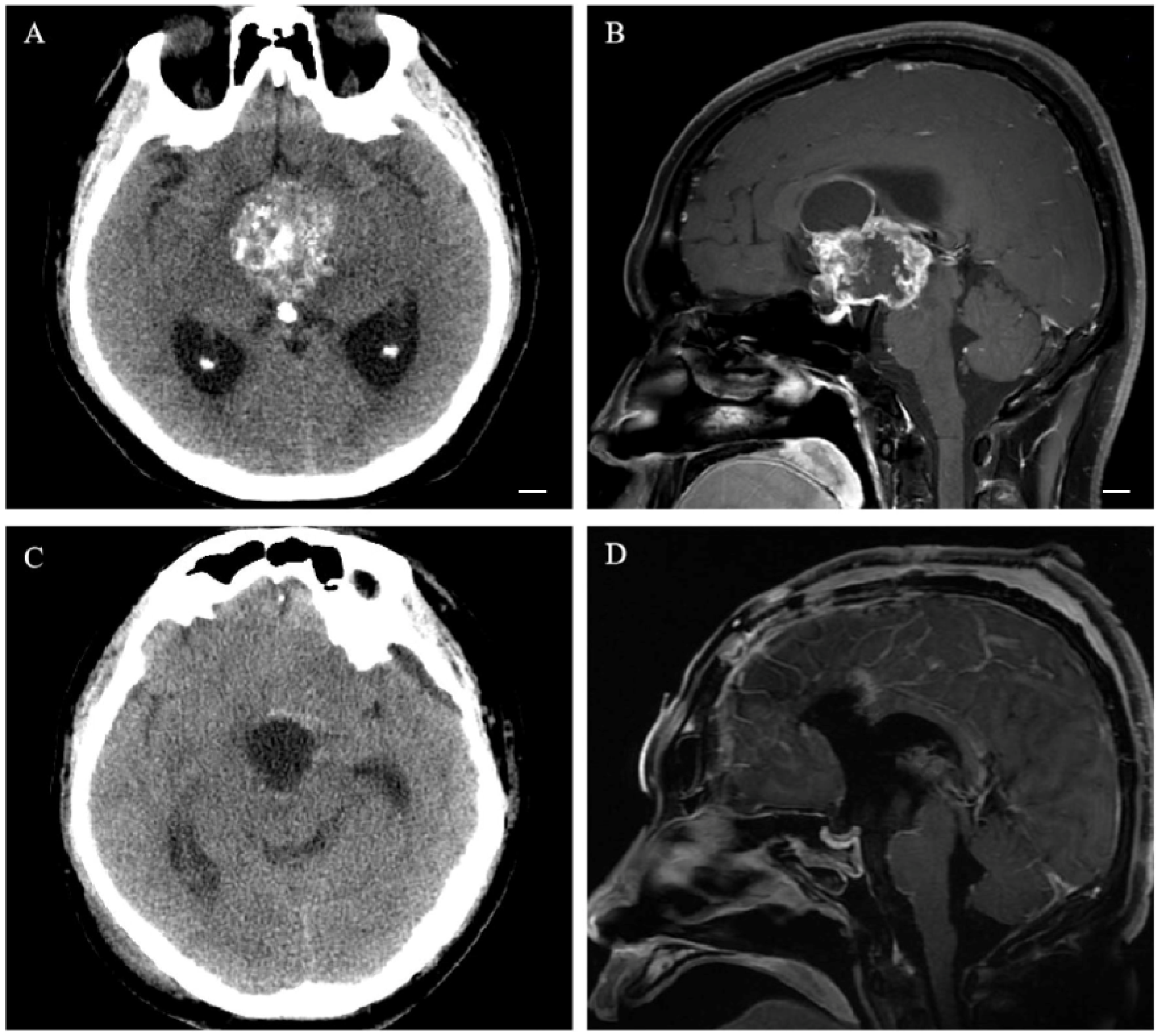 Cancers 15 00340 g002