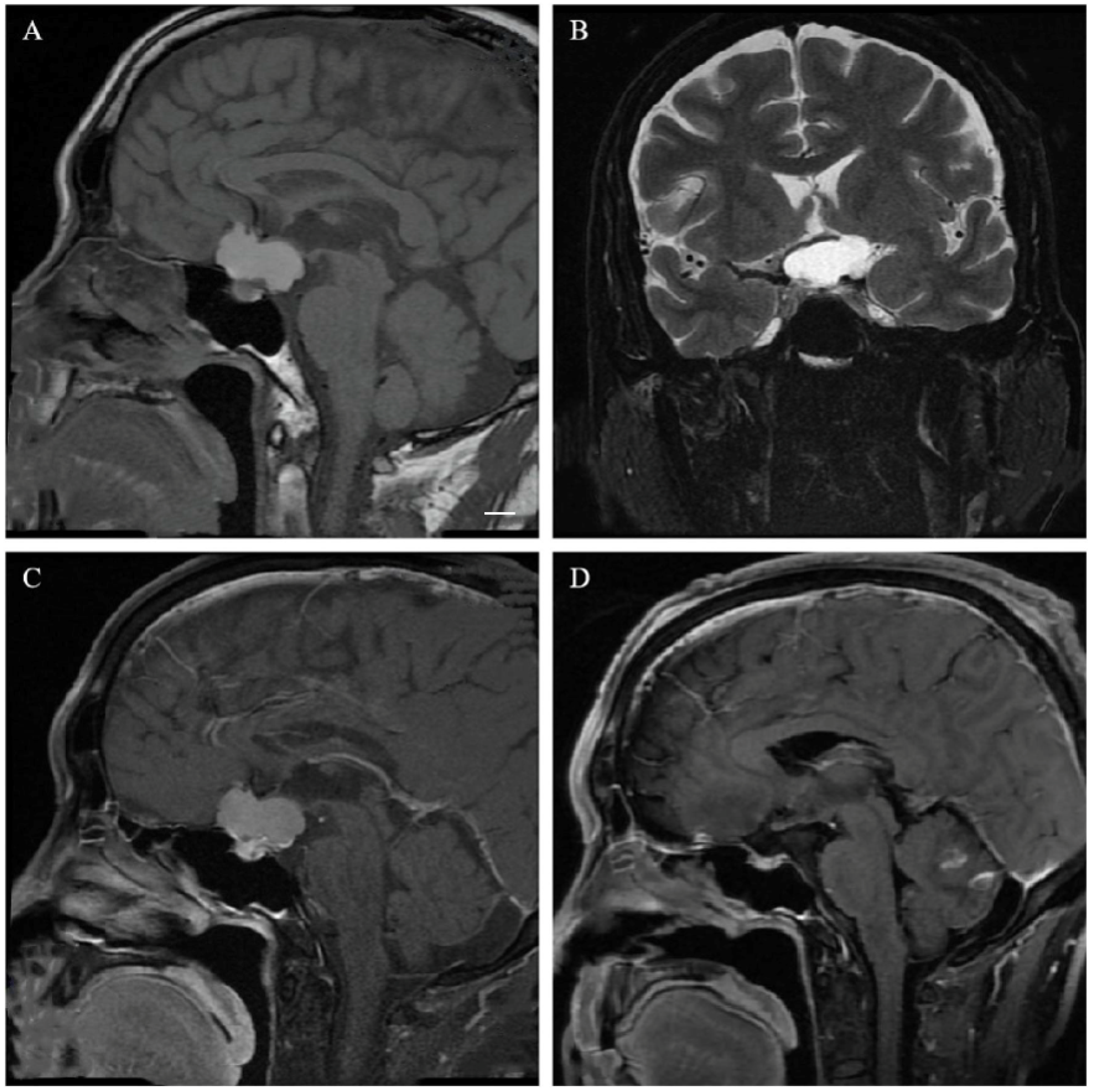 Cancers 15 00340 g003