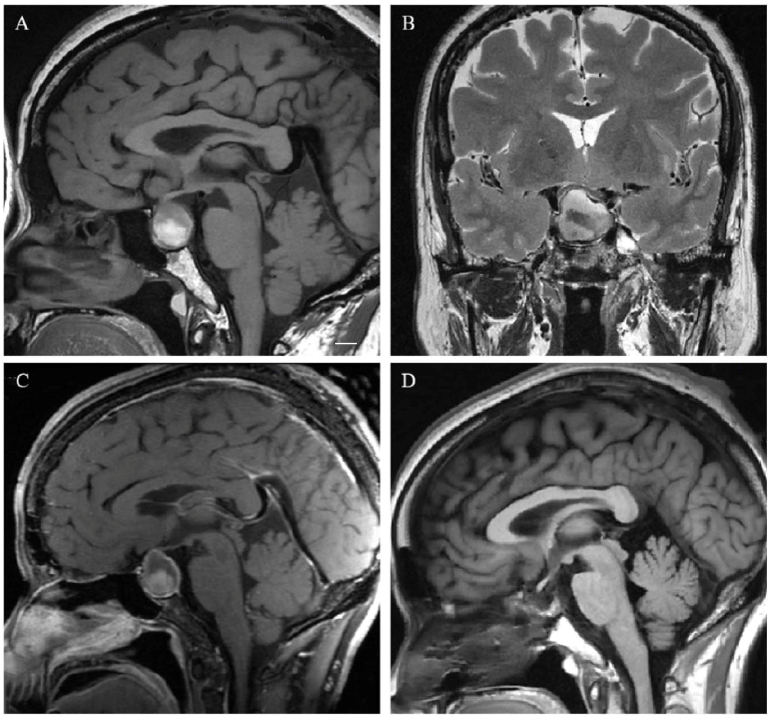 Cancers 15 00340 g004