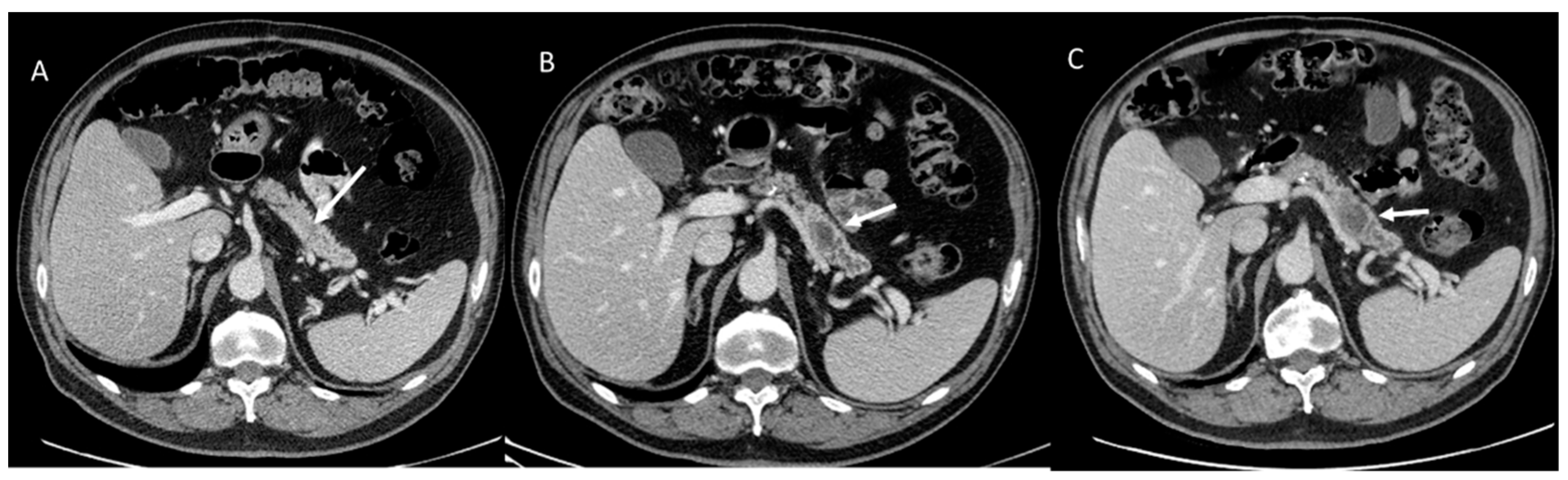 Cancers 15 00351 g001