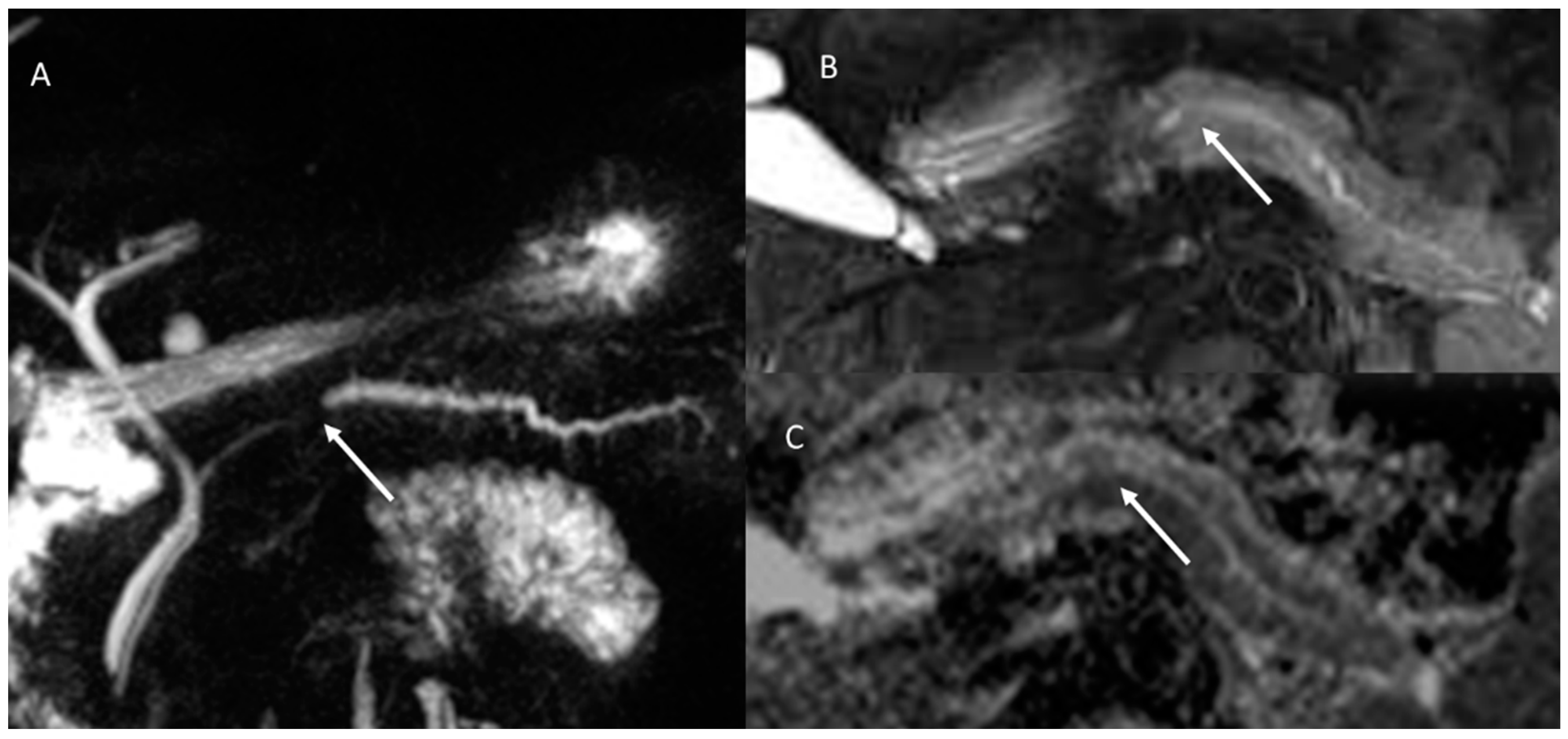 Cancers 15 00351 g002