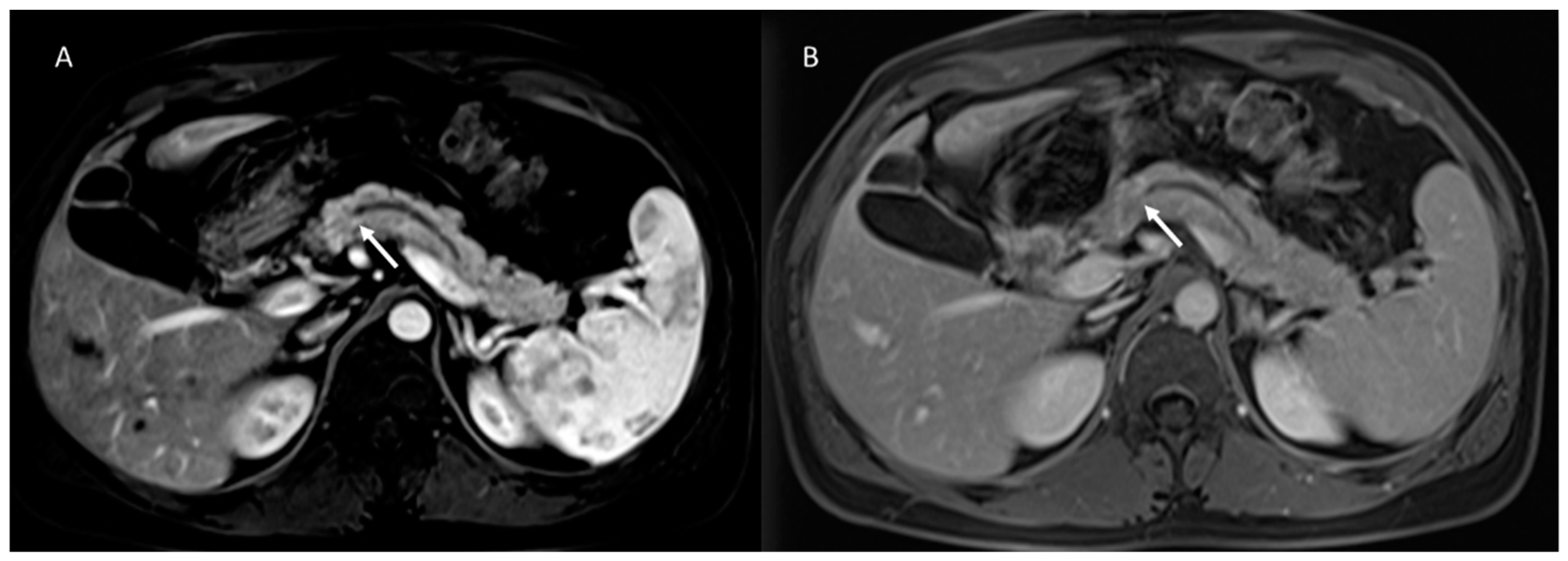 Cancers 15 00351 g003