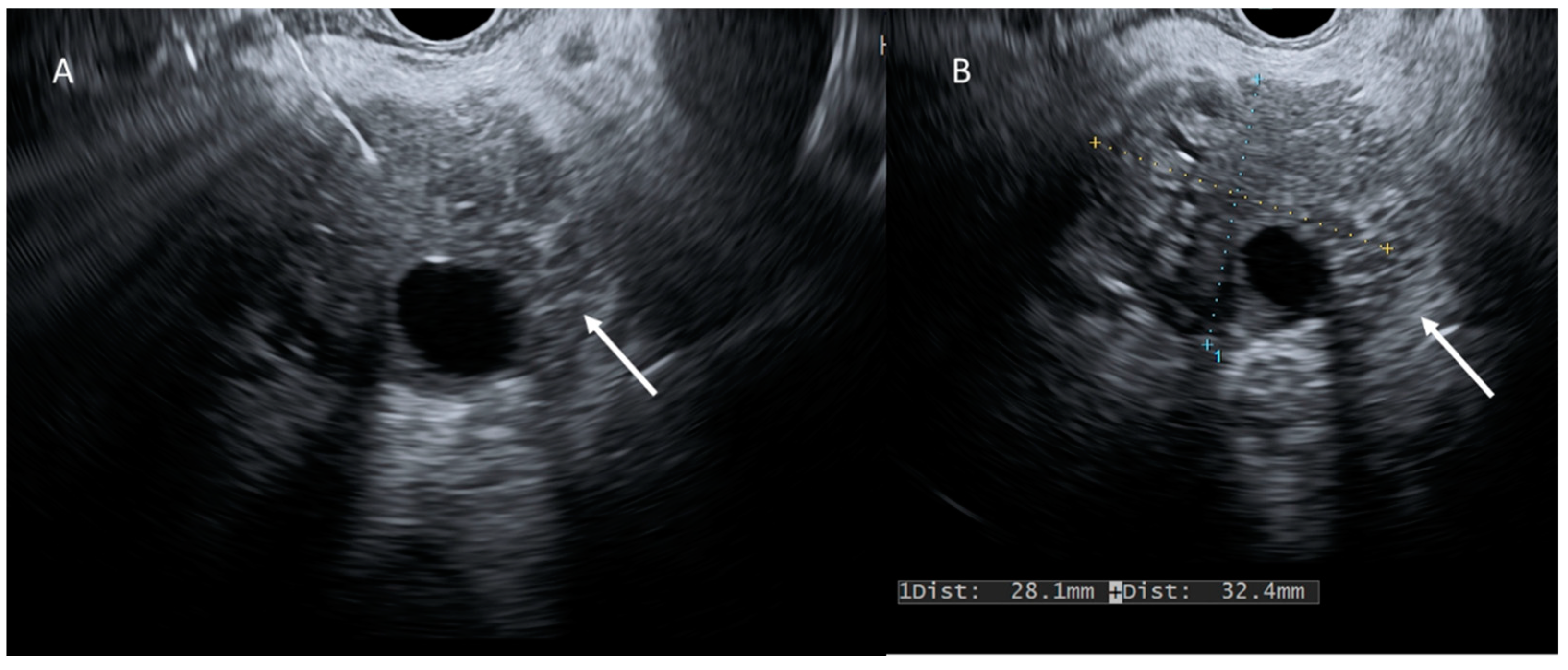 Cancers 15 00351 g004