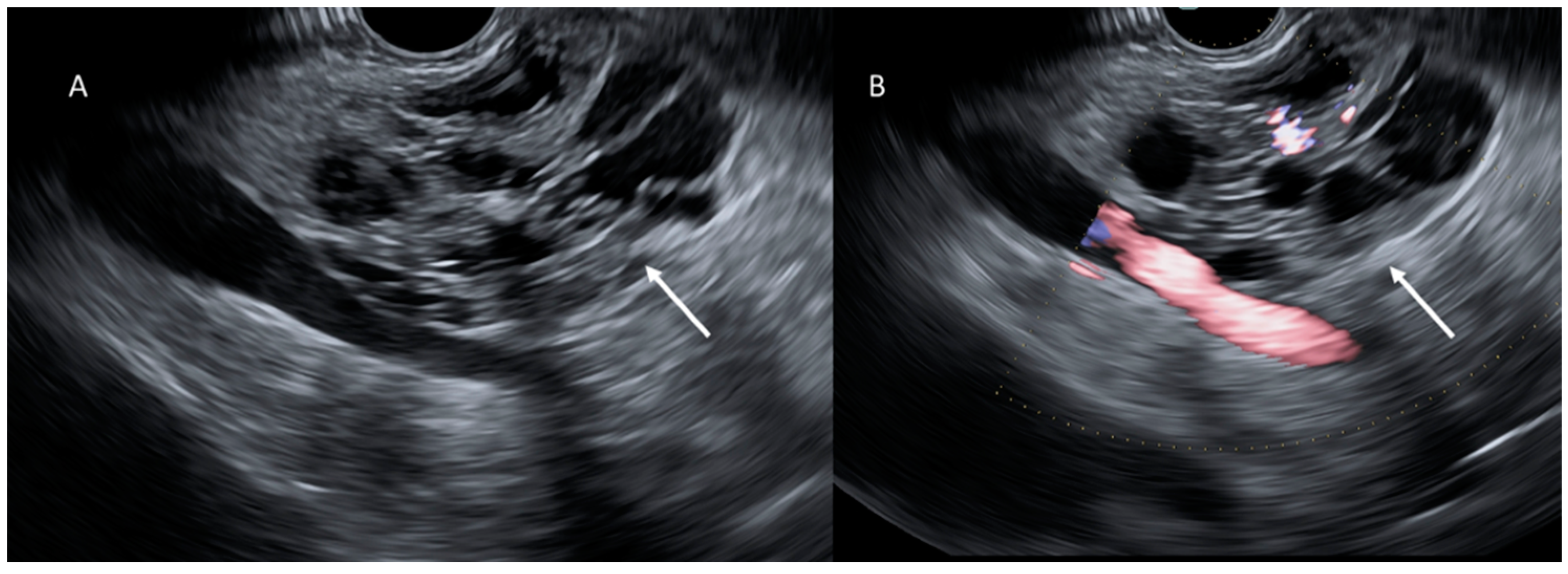Cancers 15 00351 g005