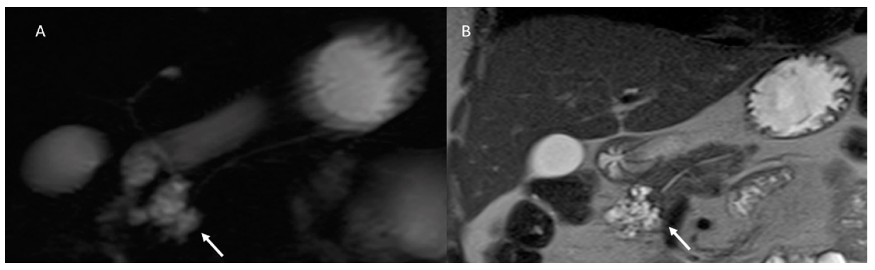 Cancers 15 00351 g006