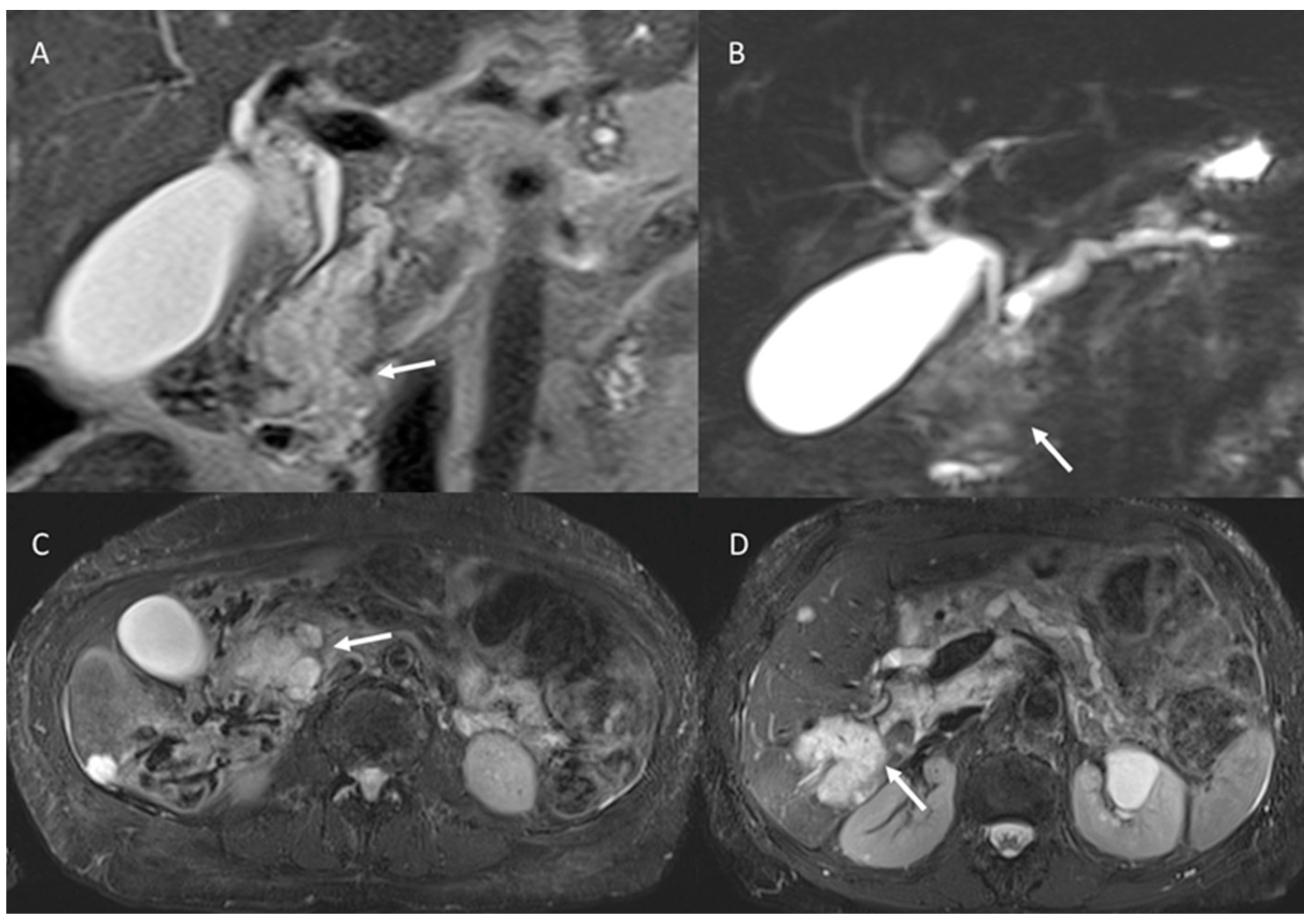 Cancers 15 00351 g007