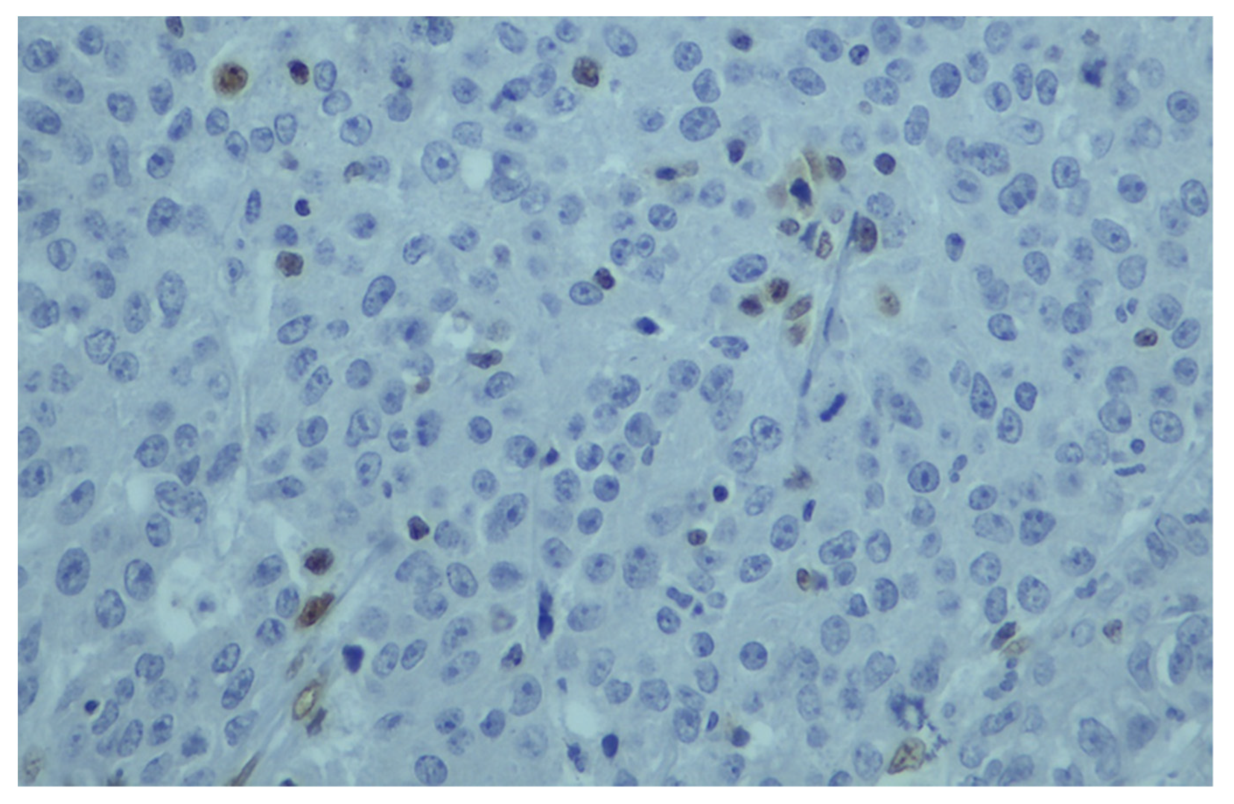 Cancers 15 00353 g003