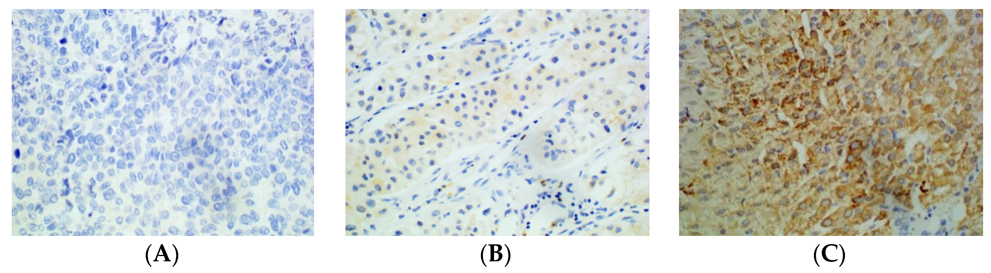 Cancers 15 00365 g003