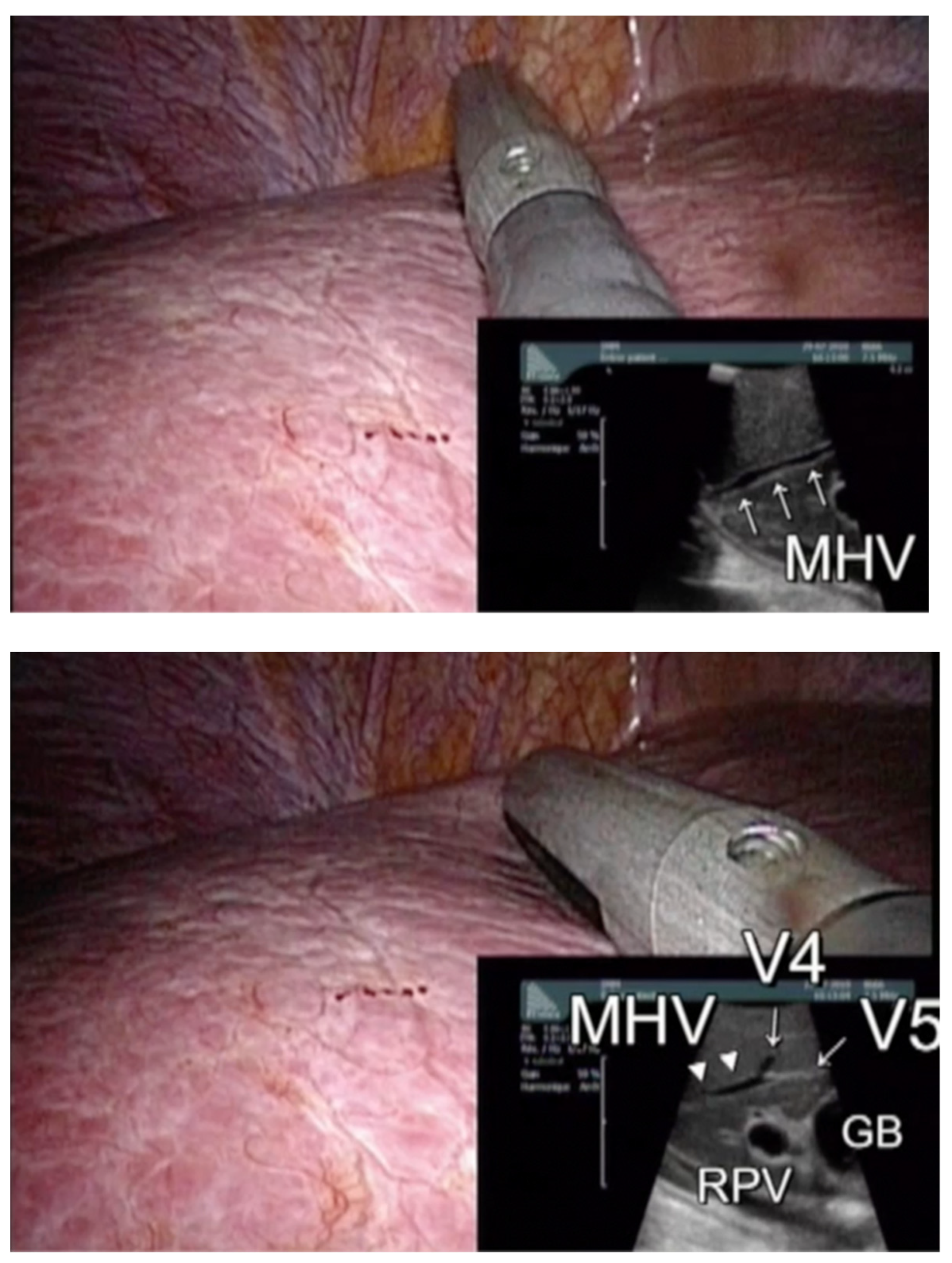 Cancers 15 00435 g001