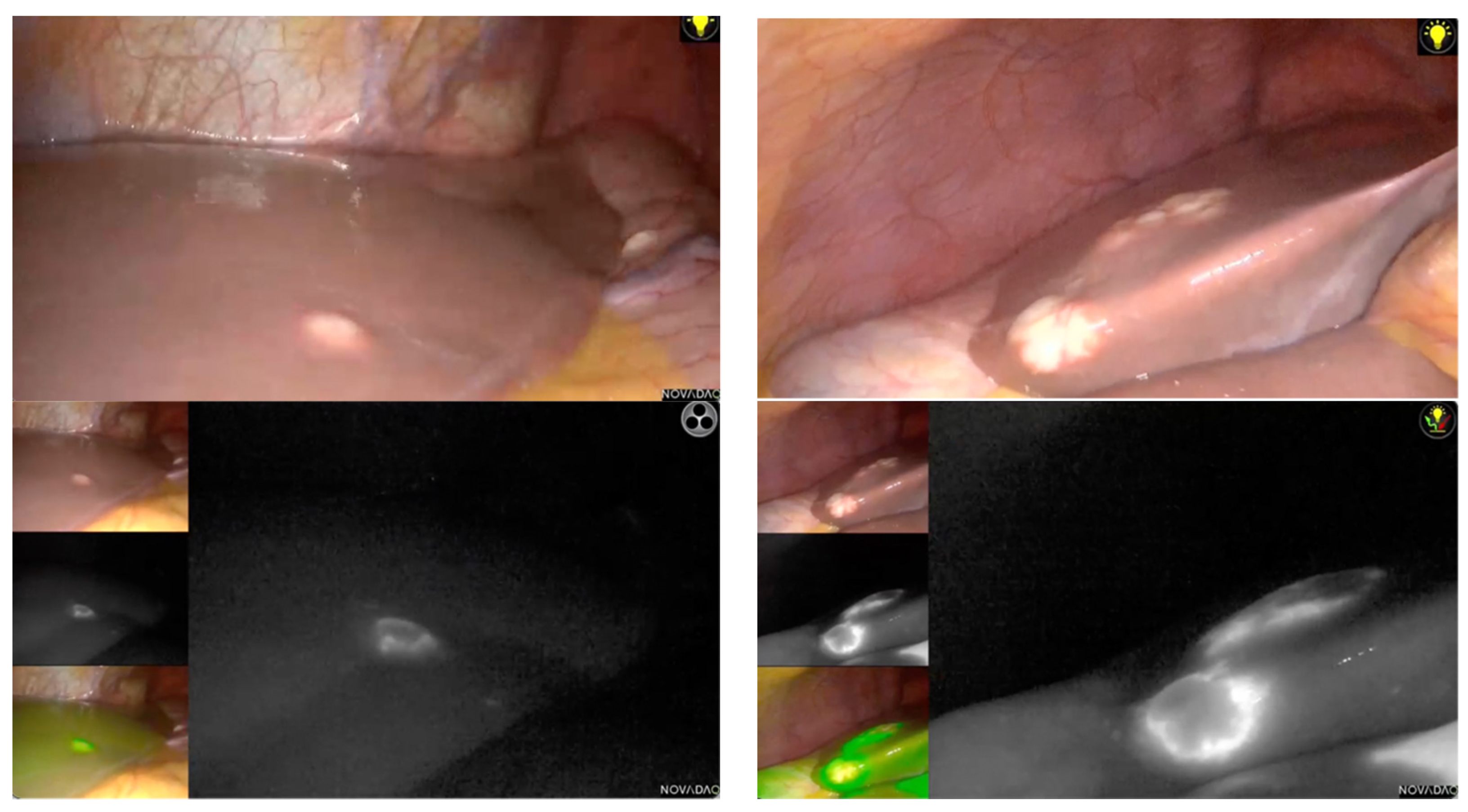 Cancers 15 00435 g002