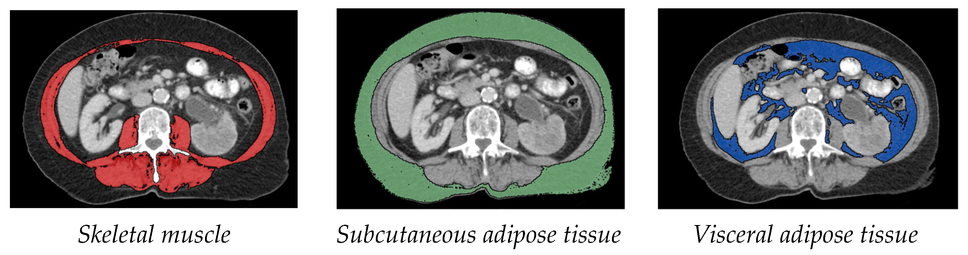 Cancers 15 00450 g001 Cancers 15 00450 g001