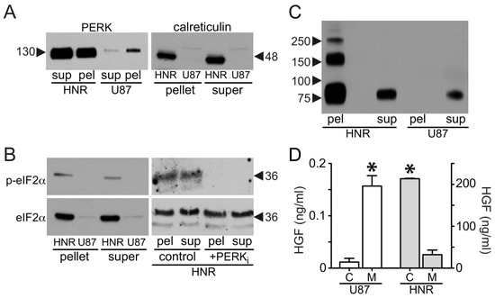 Cancers 15 00460 g008