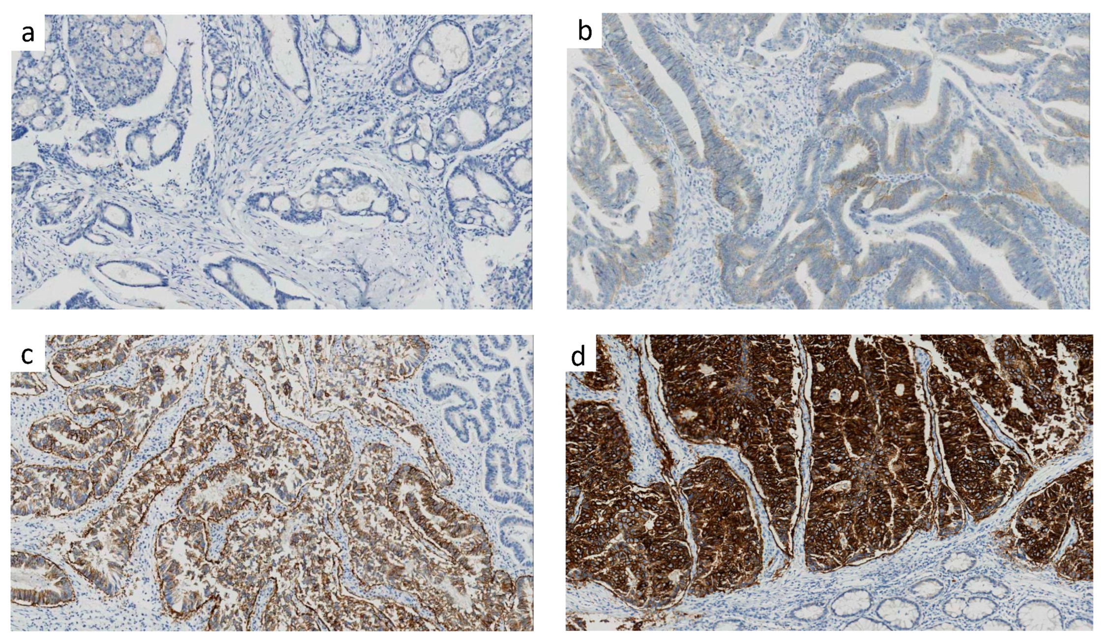 Cancers 15 00554 g002