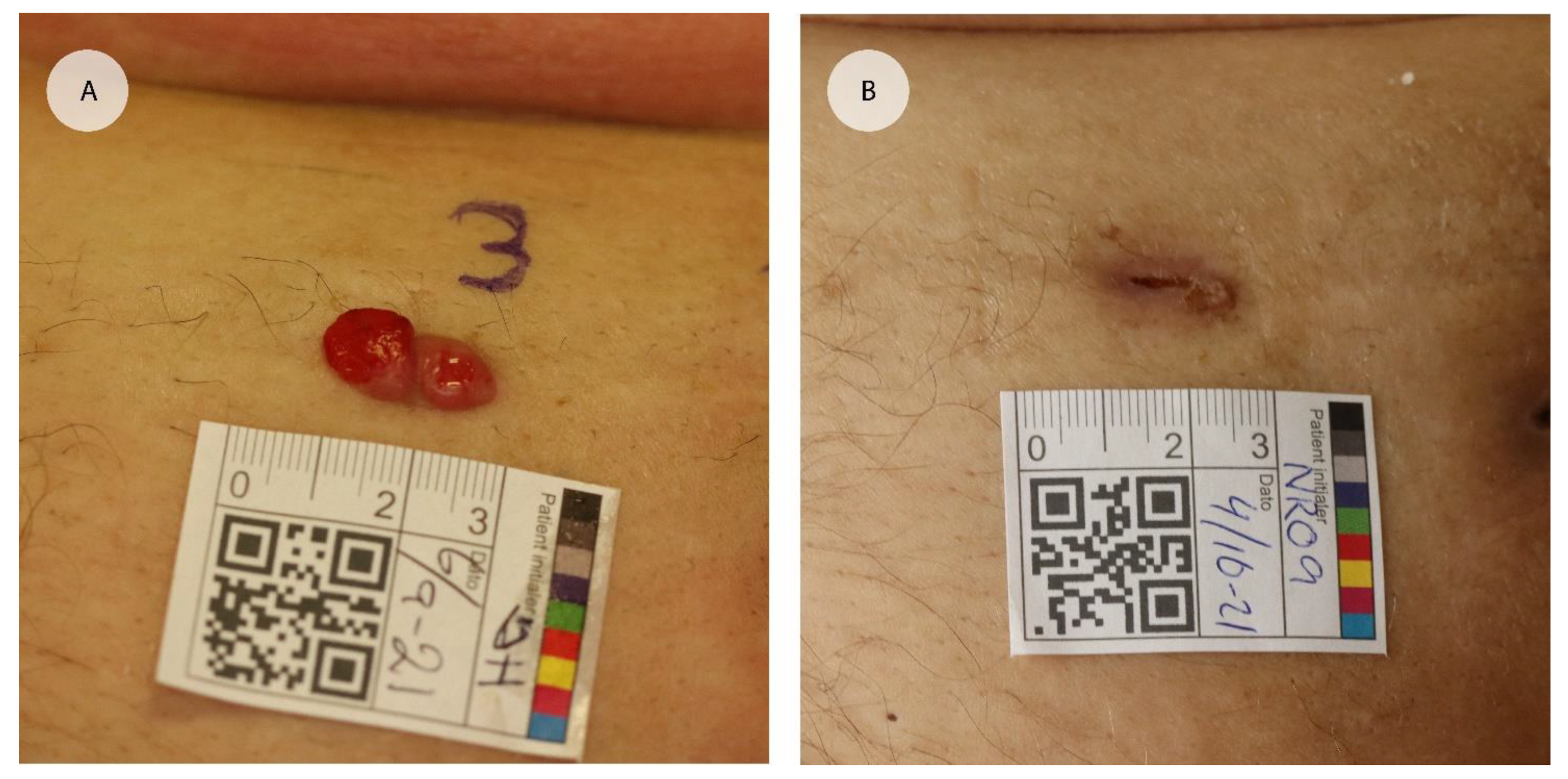 Cancers 15 00599 g002