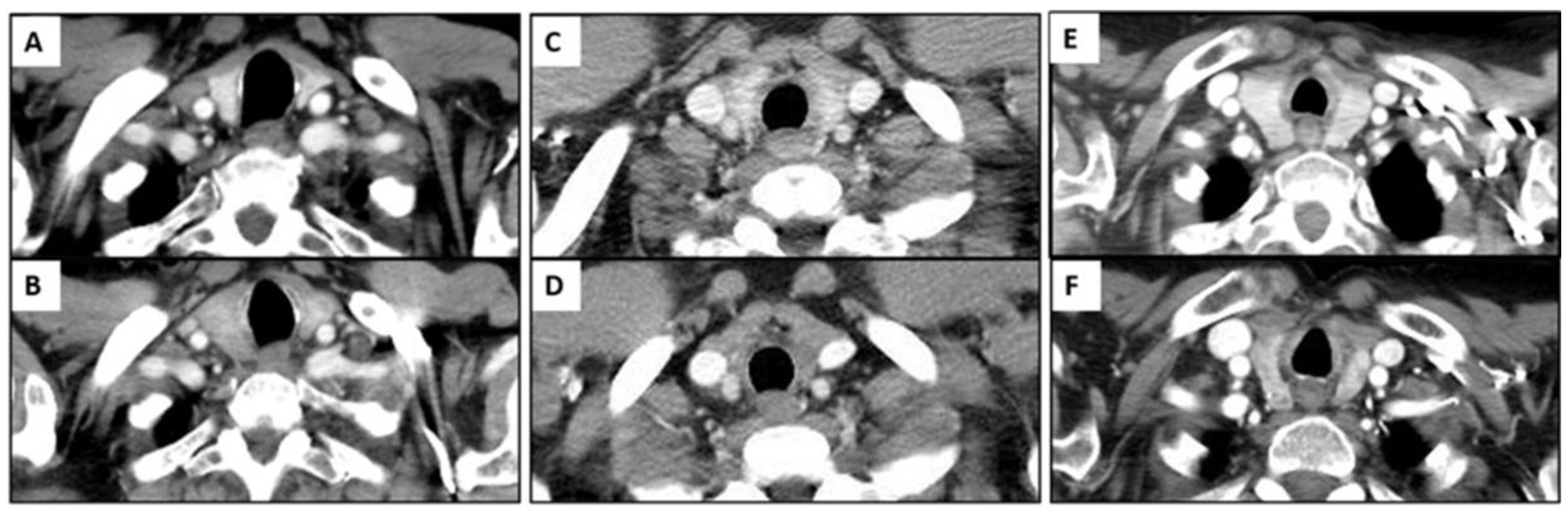Cancers 15 00649 g002 Cancers 15 00649 g002