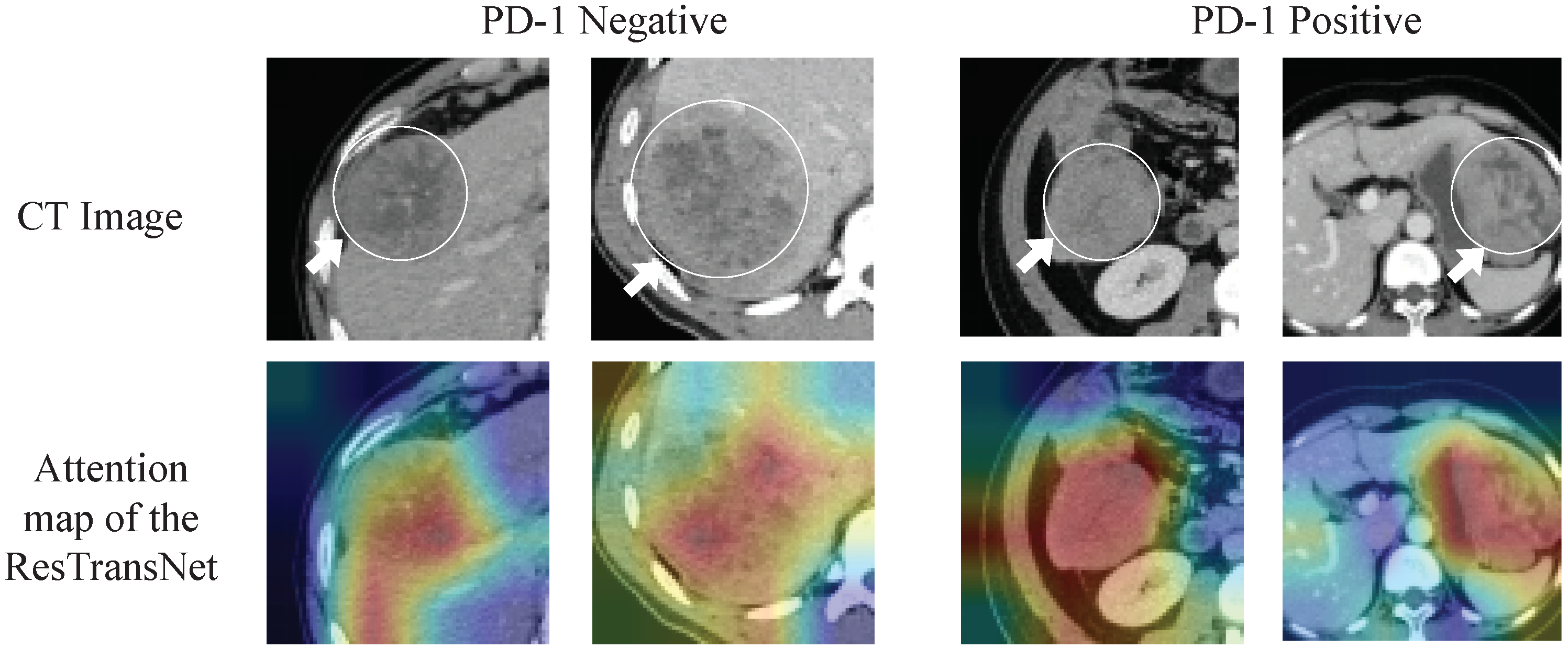 Cancers 15 00658 g006