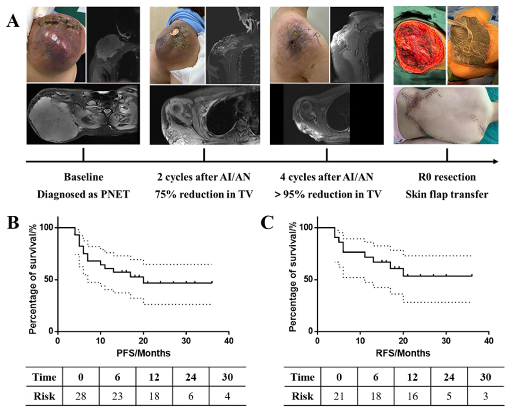 Cancers 15 00700 g003