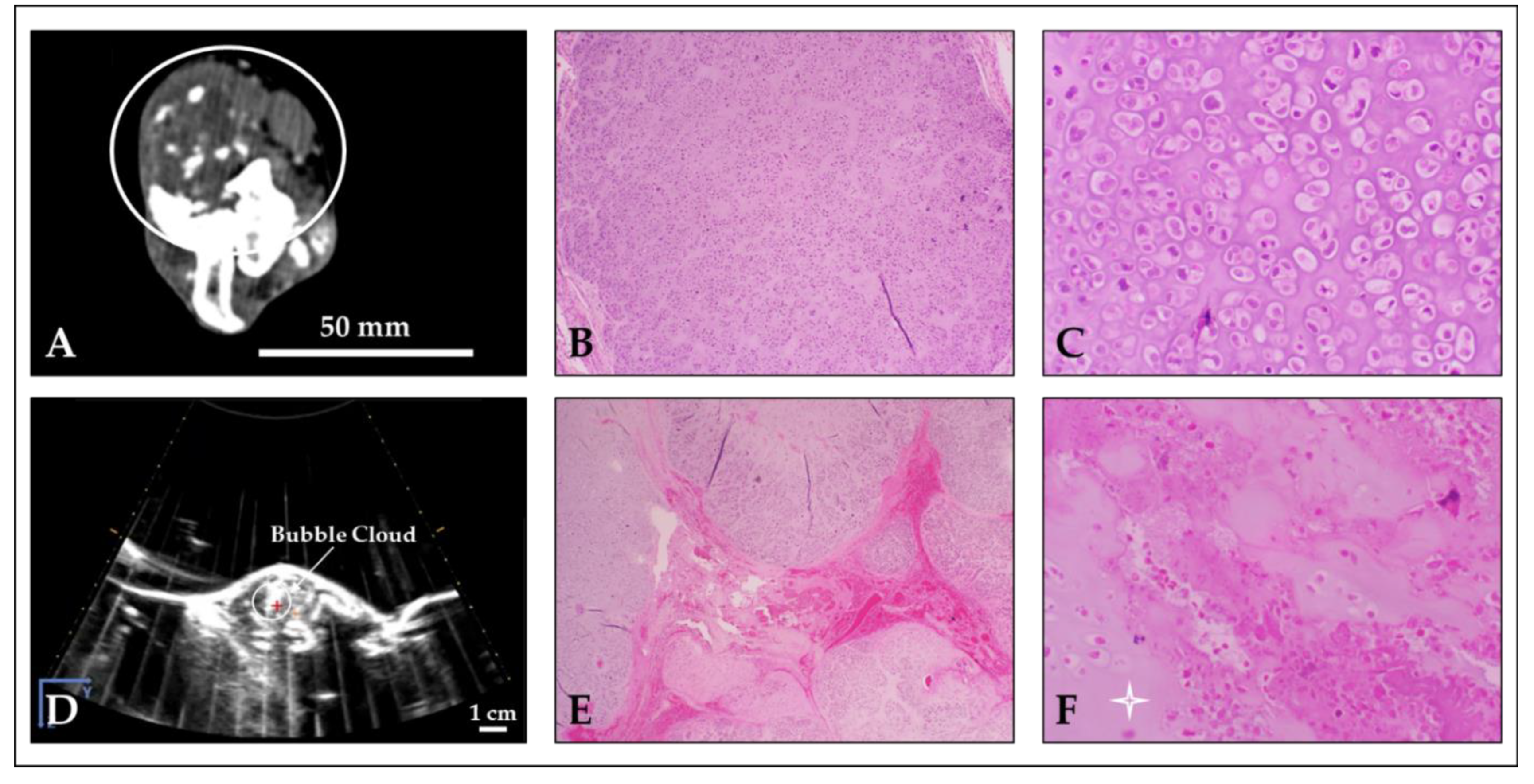 Cancers 15 00741 g004