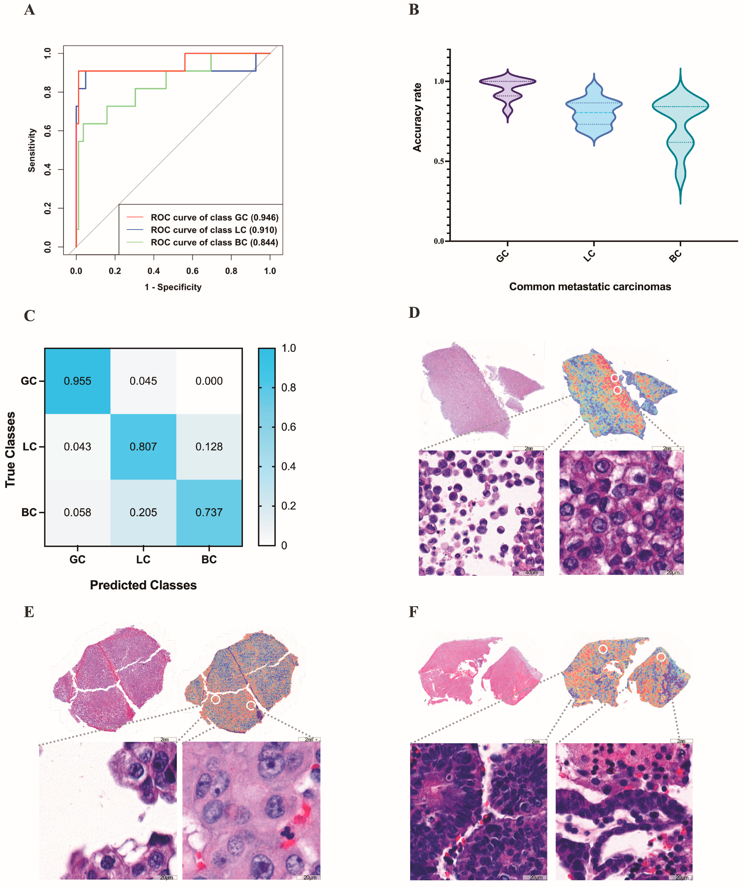 Cancers 15 00752 g007