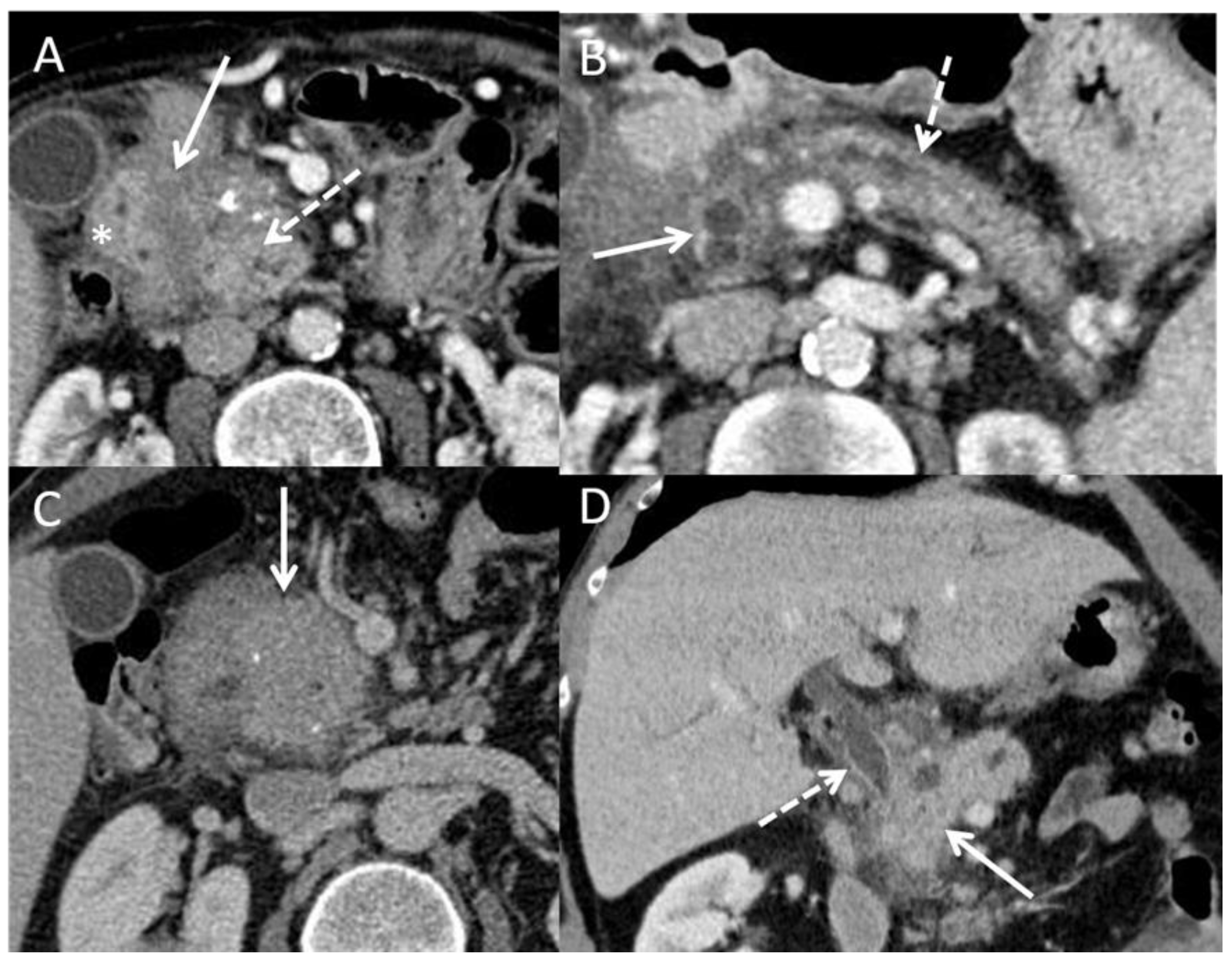 Cancers 15 00761 g003