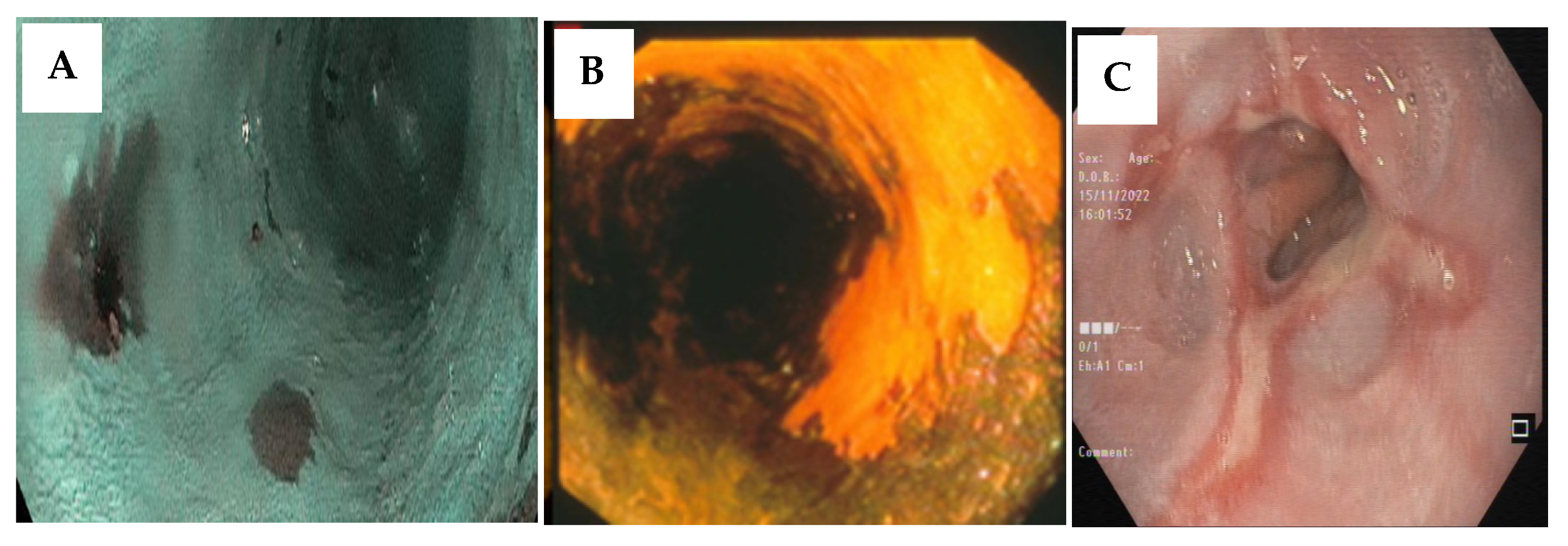 Cancers 15 00765 g003