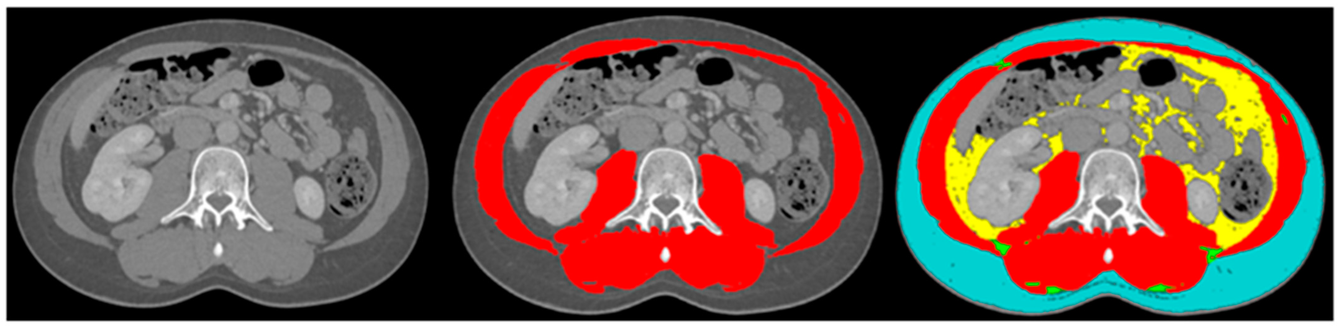 Cancers 15 00782 g001 Cancers 15 00782 g001