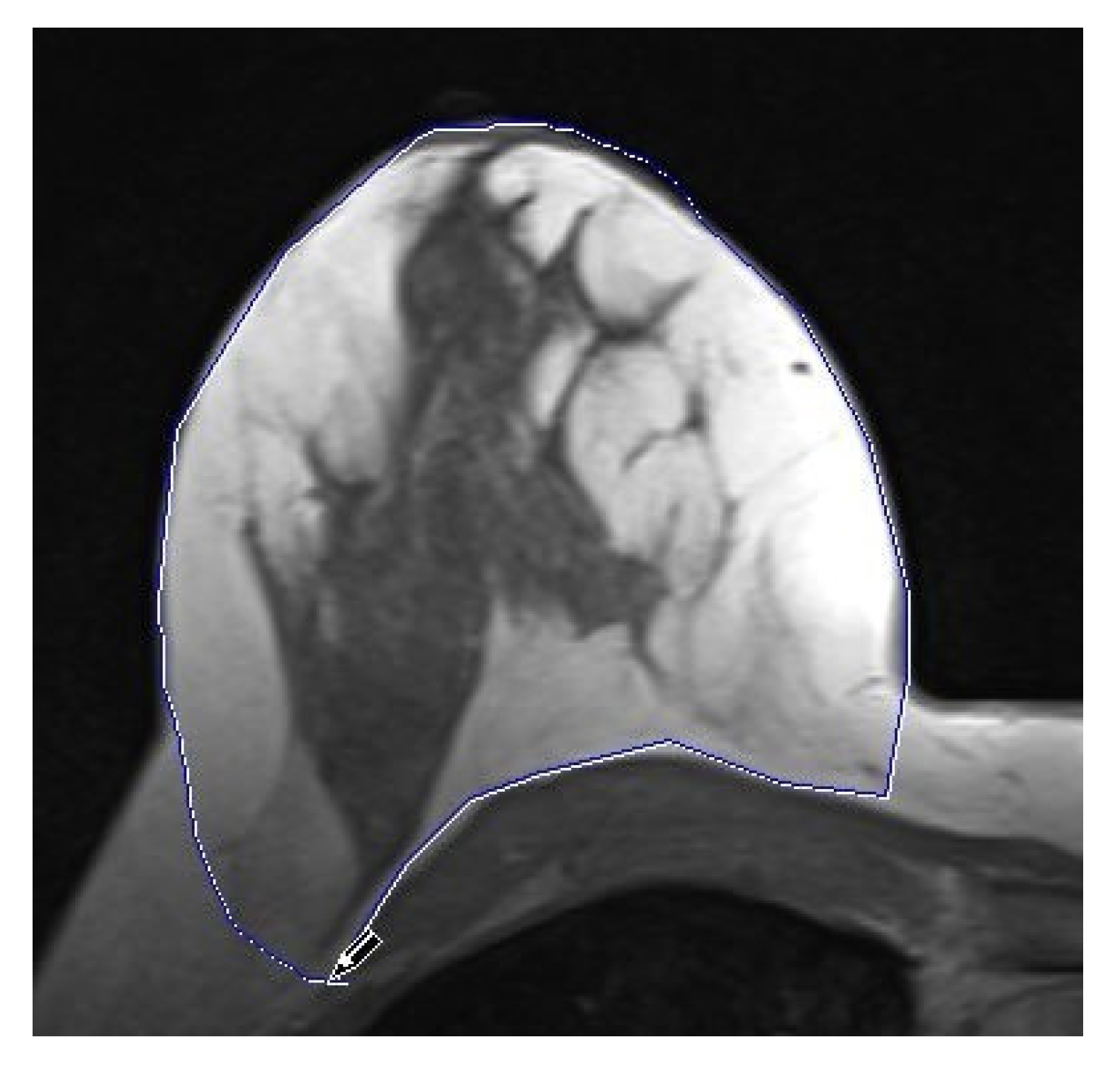 Cancers 15 00829 g004