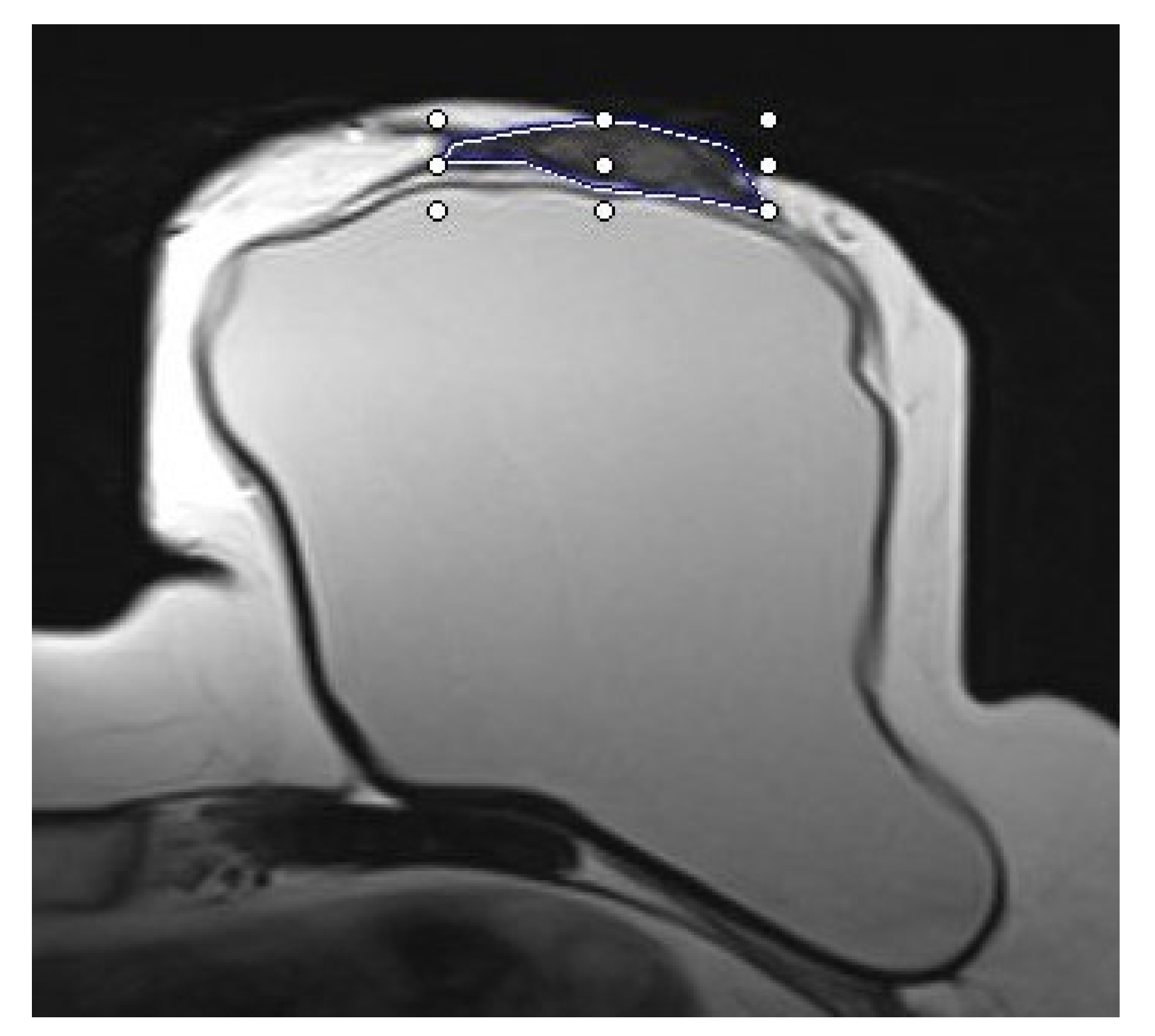 Cancers 15 00829 g005