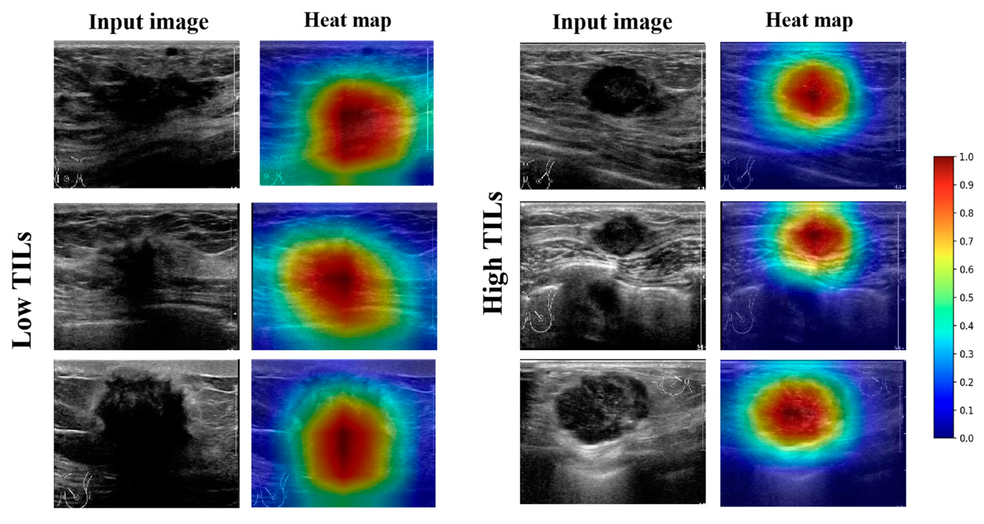 Cancers 15 00838 g006