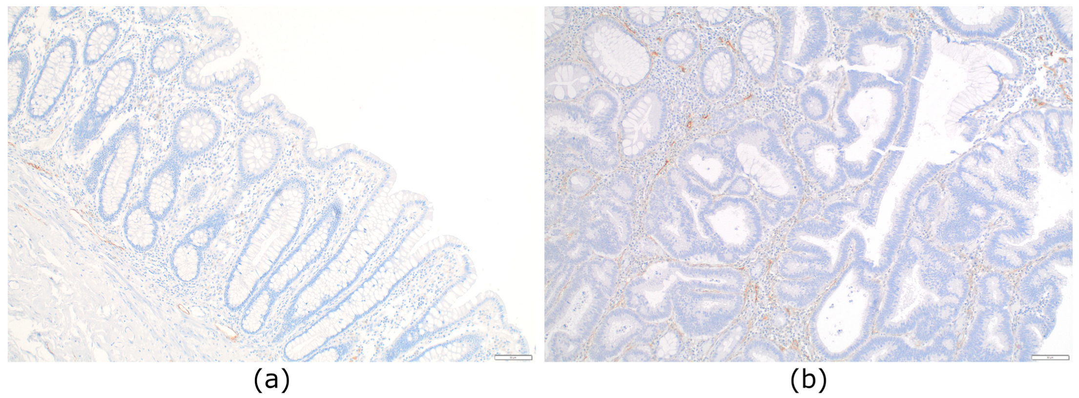 Cancers 15 00842 g001 Cancers 15 00842 g001