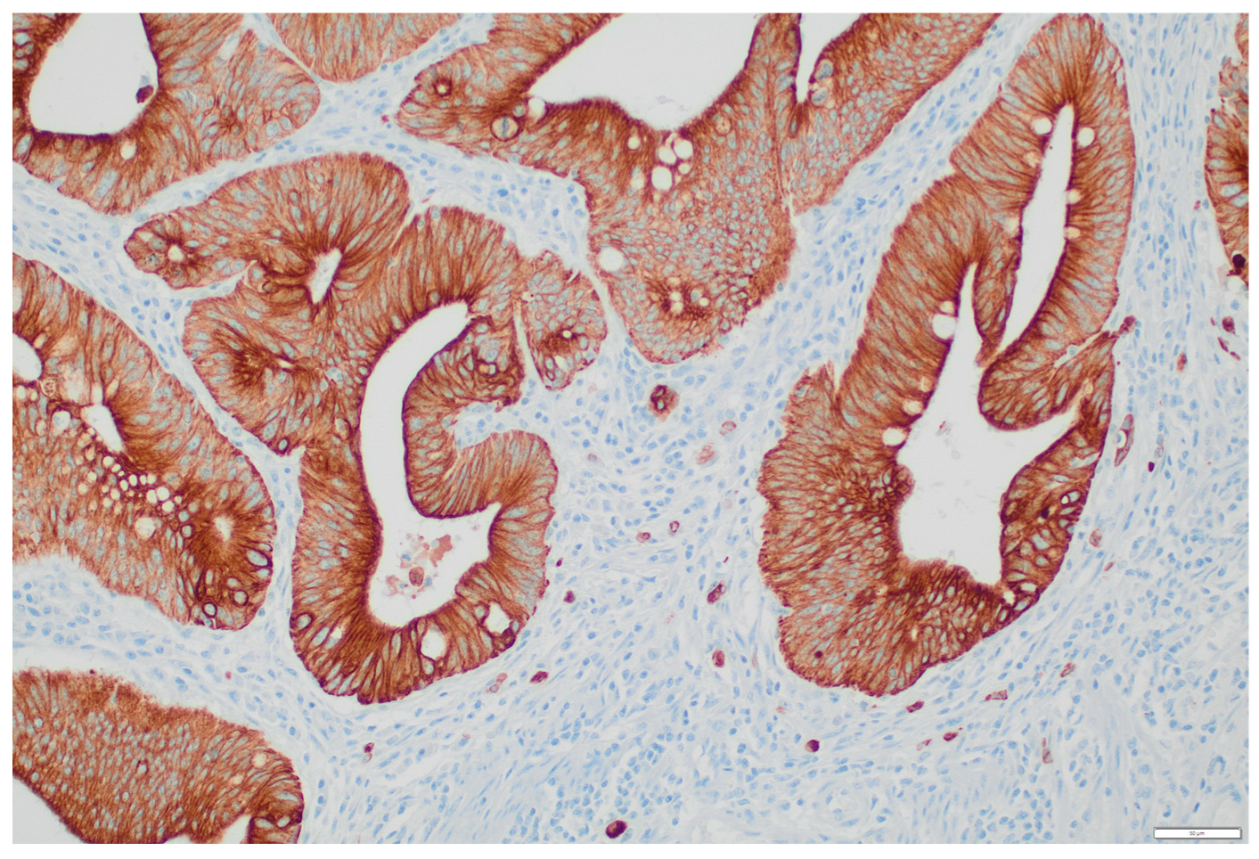 Cancers 15 00842 g002 Cancers 15 00842 g002