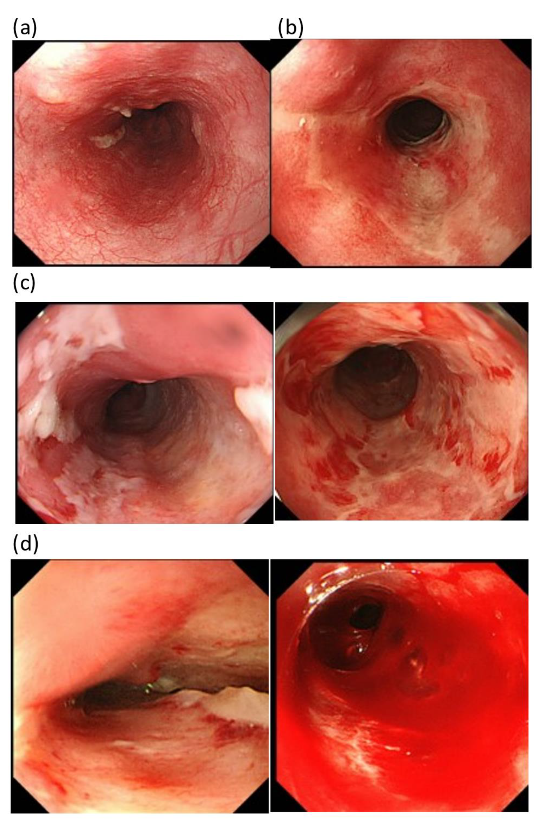 Cancers 15 00860 g001 Cancers 15 00860 g001