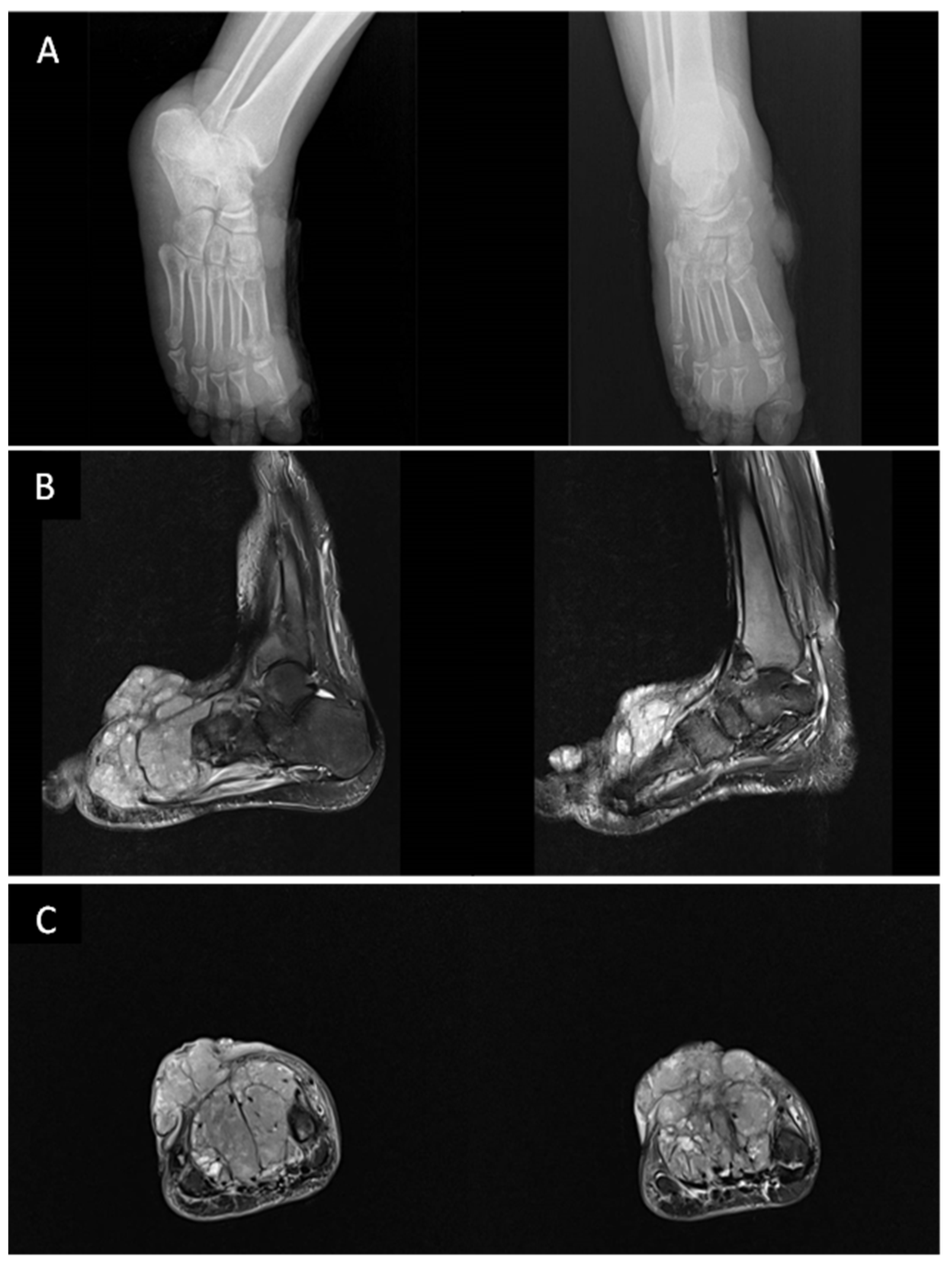 Cancers 15 00872 g002