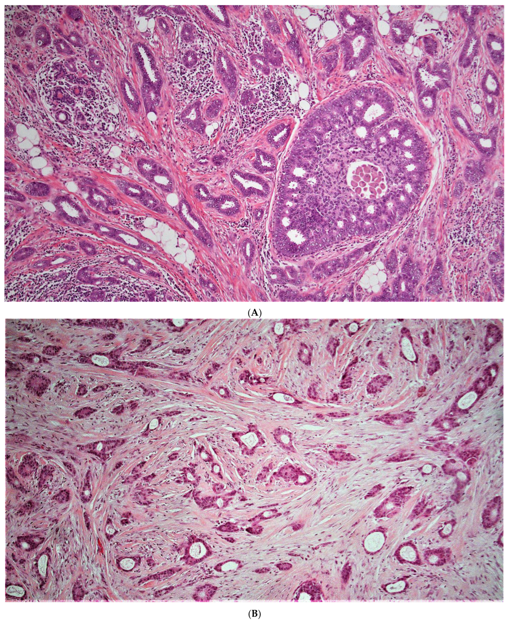 Cancers 15 00903 g003