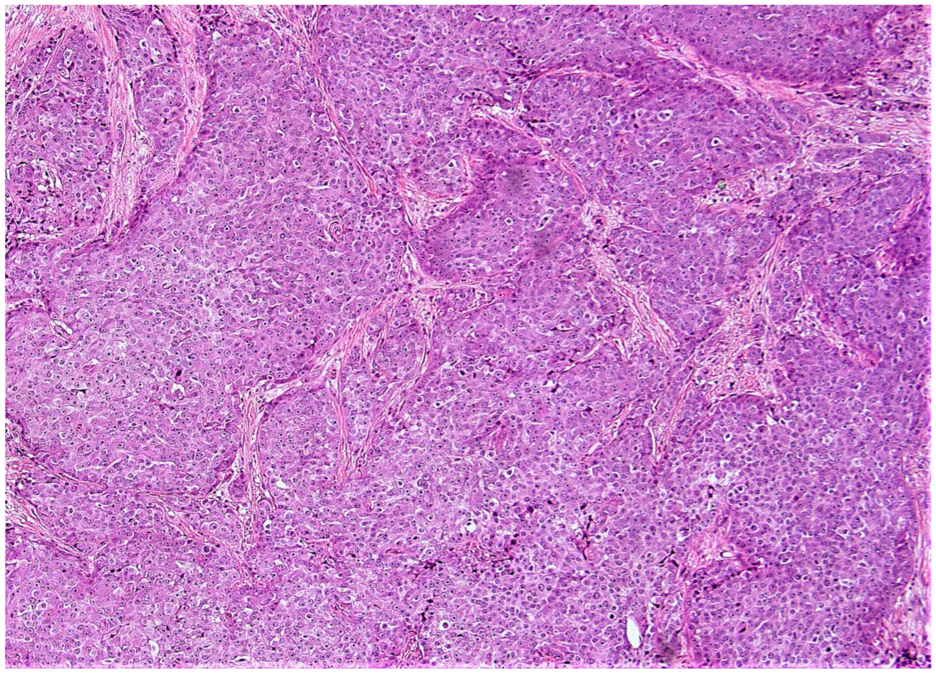 Cancers 15 00903 g006