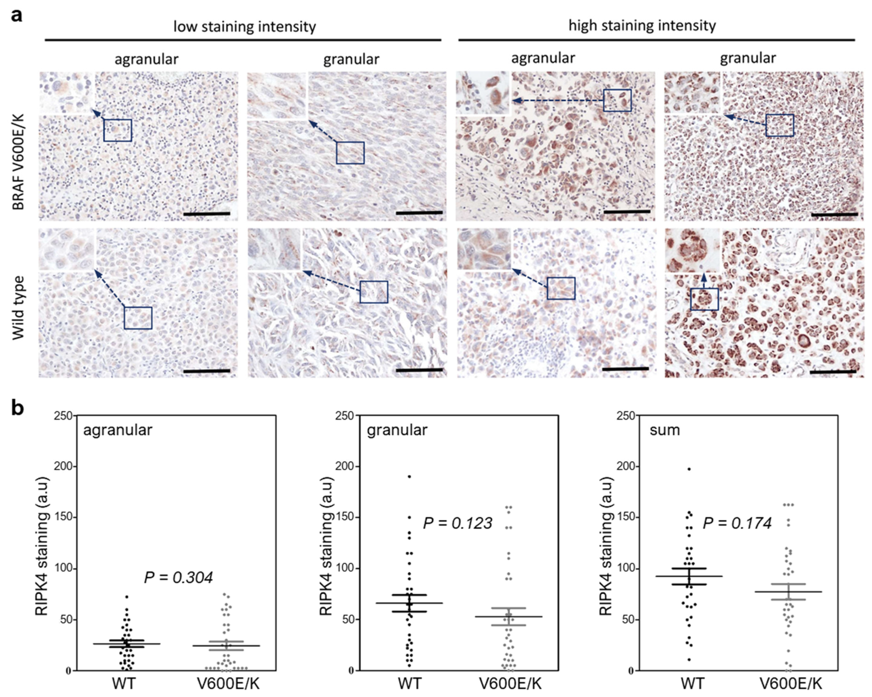 Cancers 15 00918 g002